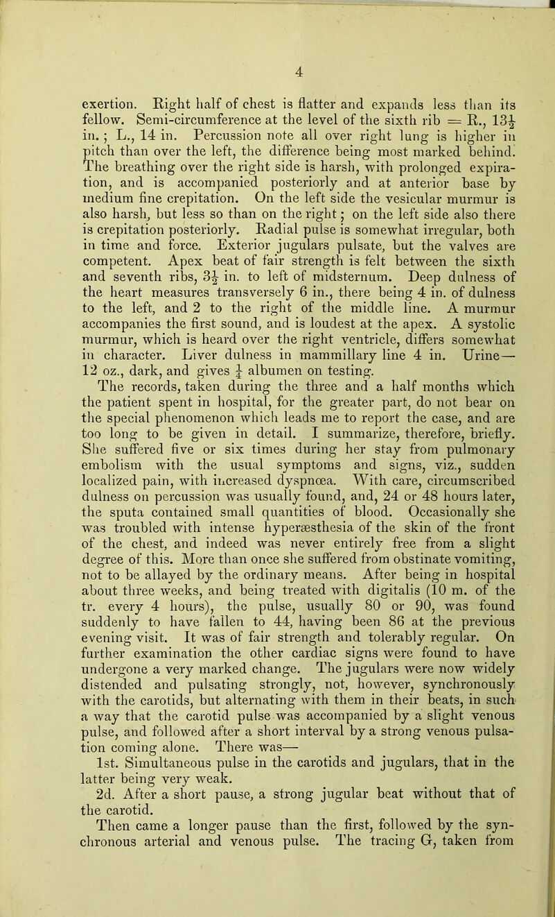 exertion. Right half of chest is flatter and expands less than its fellow. Semi-circumference at the level of the sixth rib = R., 13^ in. ; L., 14 in. Percussion note all over right lung is higher in pitch than over the left, the difference being most marked behind. The breathing over the right side is harsh, with prolonged expira- tion, and is accompanied posteriorly and at anterior base by medium fine crepitation. On the left side the vesicular murmur is also harsh, but less so than on the right; on the left side also there is crepitation posteriorly. Radial pulse is somewhat irregular, both in time and force. Exterior jugulars pulsate, but the valves are competent. Apex beat of fair strength is felt between the sixth and seventh ribs, 3^ in. to left of midsternum. Deep dulness of the heart measures transversely 6 in., there being 4 in. of dulness to the left, and 2 to the right of the middle line. A murmur accompanies the first sound, and is loudest at the apex. A systolic murmur, which is heard over the right ventricle, differs somewhat in character. Liver dulness in mammillary line 4 in. Urine— 12 oz., dark, and gives J albumen on testing. The records, taken during the three and a half months which the patient spent in hospital, for the greater part, do not bear on the special phenomenon which leads me to report the case, and are too long to be given in detail. I summarize, therefore, briefly. She suffered five or six times during her stay from pulmonary embolism with the usual symptoms and signs, viz., sudden localized pain, with increased dyspnoea. With care, circumscribed dulness on percussion was usually found, and, 24 or 48 hours later, the sputa contained small quantities of blood. Occasionally she was troubled with intense hypersesthesia of the skin of the front of the chest, and indeed was never entirely free from a slight degree of this. More than once she suffered from obstinate vomiting, not to be allayed by the ordinary means. After being in hospital about three weeks, and being treated with digitalis (10 m. of the tr. every 4 hours), the pulse, usually 80 or 90, was found suddenly to have fallen to 44, having been 86 at the previous evening visit. It was of fair strength and tolerably regular. On further examination the other cardiac signs were found to have undergone a very marked change. The jugulars were now widely distended and pulsating strongly, not, however, synchronously with the carotids, but alternating with them in their beats, in such a way that the carotid pulse was accompanied by a slight venous pulse, and followed after a short interval by a strong venous pulsa- tion coming alone. There was— 1st. Simultaneous pulse in the carotids and jugulars, that in the latter being very weak. 2d. After a short pause, a strong jugular beat without that of the carotid. Then came a longer pause than the first, followed by the syn- chronous arterial and venous pulse. The tracing G, taken from
