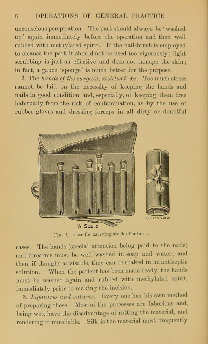 unconscious perspiration. The part should always be ‘ washed up ’ again immediately before the operation and then well rubbed with methylated spirit. If the nail-brush is employed to cleanse the part, it should not be used too vigorously; light scrubbing is just as effective and does not damage the skin; in fact, a gauze ‘ sponge ’ is much better for the purpose. 2. The hands of the surgeon, assistant, &c. Too much stress cannot be laid on the necessity of keeping the hands and nails in good condition and, especially, of keeping them free habitually from the risk of contamination, as by the use of rubber gloves and dressing forceps in all dirty or doubtful Closed View Fig. 2. Case for carrying stock of sutures. cases. The hands (special attention being paid to the nails) and forearms must be well washed in soap and water, and then, if thought advisable, they can be soaked in an antiseptic solution. When the patient has been made ready, the hands must be washed again and rubbed with methylated spirit, immediately prior to making the incision. 3. Ligatures and sutures. Every one has his own method of preparing these. Most of the processes are laborious and, being wet, have the disadvantage of rotting the material, and rendering it unreliable. Silk is the material most frequently