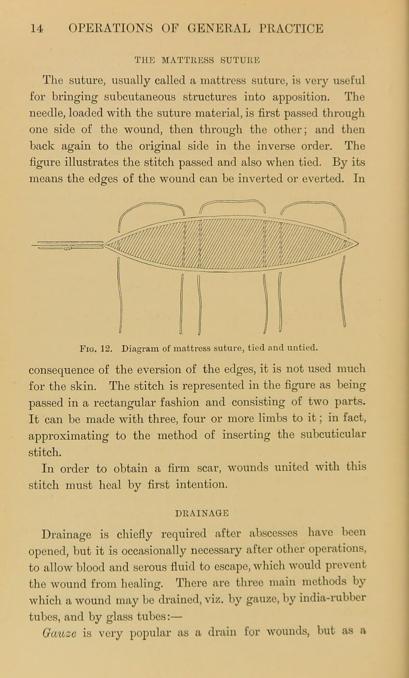 THE MATTRESS SUTURE The suture, usually called a mattress suture, is very useful for bringing subcutaneous structures into apposition. The needle, loaded with the suture material, is first passed through one side of the wound, then through the other; and then back again to the original side in the inverse order. The figure illustrates the stitch passed and also when tied. By its means the edges of the wound can be inverted or everted. In consequence of the eversion of the edges, it is not used much for the skin. The stitch is represented in the figure as being passed in a rectangular fashion and consisting of two parts. It can be made with three, four or more limbs to it; in fact, approximating to the method of inserting the subcuticular stitch. In order to obtain a firm scar, wounds united with this stitch must heal by first intention. DRAINAGE Drainage is chiefly required after abscesses have been opened, but it is occasionally necessary after other operations, to allow blood and serous fluid to escape, which would prevent the wound from healing. There are three main methods by which a wound may be drained, viz. by gauze, by india-rubber tubes, and by glass tubes:— Gauze is very popular as a drain for wounds, but as a