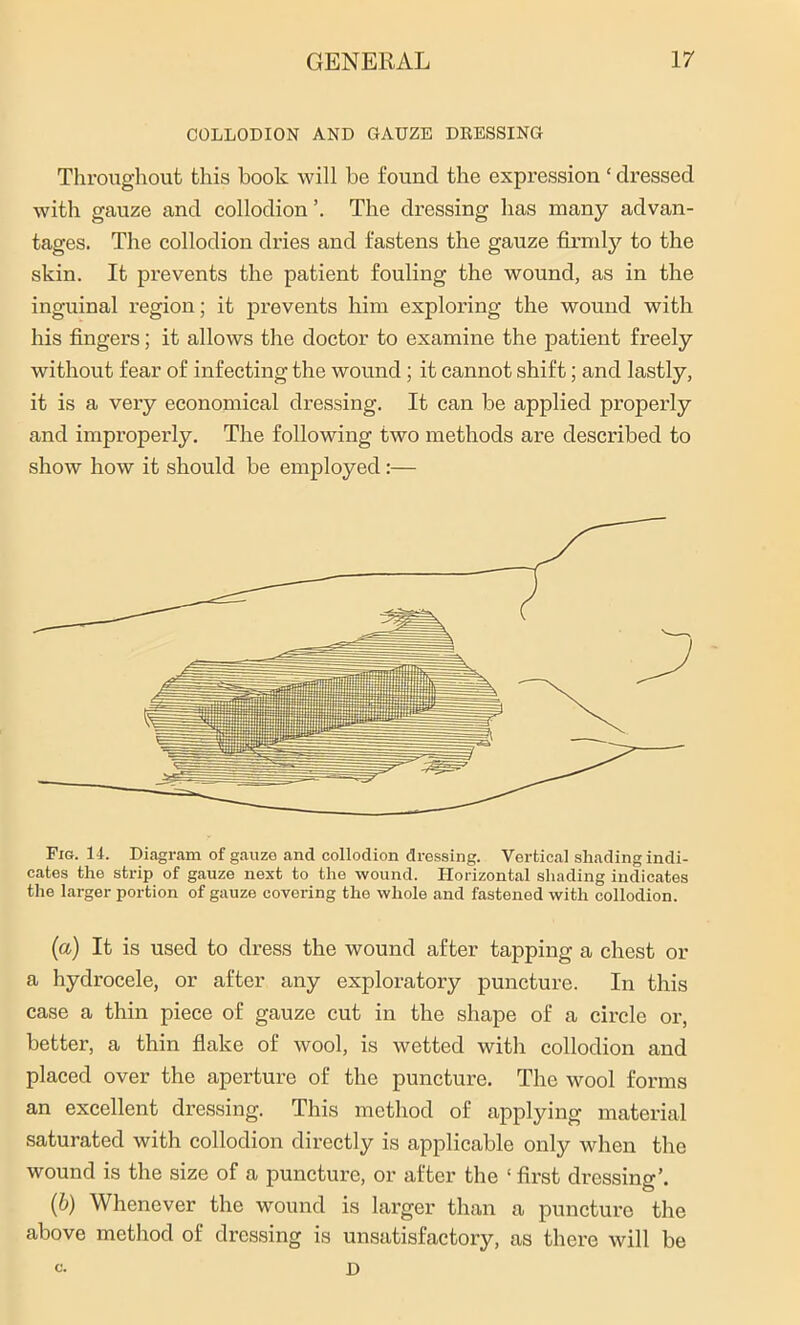 COLLODION AND GAUZE DRESSING Throughout this book will be found the expression ‘ dressed with gauze and collodion ’. The dressing has many advan- tages. The collodion dries and fastens the gauze firmly to the skin. It prevents the patient fouling the wound, as in the inguinal region; it prevents him exploring the wound with his fingers; it allows the doctor to examine the patient freely without fear of infecting the wound ; it cannot shift; and lastly, it is a very economical dressing. It can be applied propeidy and improperly. The following two methods are described to show how it should be employed:— Fig. 14. Diagram of gauze and collodion dressing. Vertical shading indi- cates the strip of gauze next to the wound. Horizontal shading indicates the larger portion of gauze covering the whole and fastened with collodion. («) It is used to dress the wound after tapping a chest or a hydrocele, or after any exploratory puncture. In this case a thin piece of gauze cut in the shape of a circle or, better, a thin flake of wool, is wetted with collodion and placed over the aperture of the puncture. The wool forms an excellent dressing. This method of applying material saturated with collodion directly is applicable only when the wound is the size of a puncture, or after the ‘ first dressing’. (b) Whenever the wound is larger than a puncture the above method of dressing is unsatisfactory, as there will be