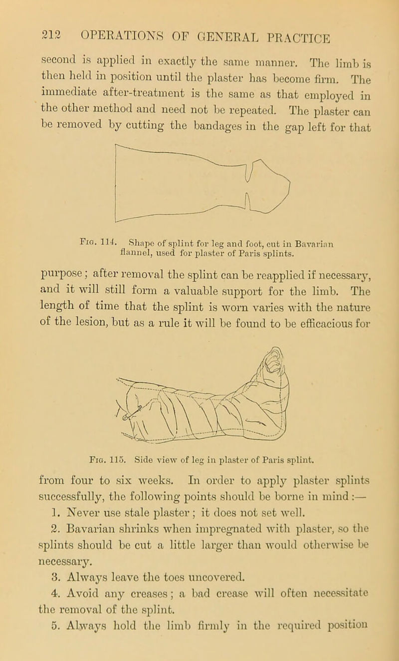 second is applied in exactly the same manner. The limb is then held in position until the plaster has become firm. The immediate after-treatment is the same as that employed in the other method and need not he repeated. The plaster can be removed by cutting the bandages in the gap left for that Fig. 114. Shape of splint for leg and foot, cut in Bavarian flannel, used for plaster of Paris splints. purpose; after removal the splint can be reapplied if necessary, and it will still form a valuable support for the limb. The length of time that the splint is worn varies with the nature of the lesion, but as a rule it will be found to be efficacious for Fig. 115. Side view of leg in plaster of Paris splint. from four to six weeks. In order to apply plaster splints successfully, the following points should be borne in mind:— 1. Never use stale plaster; it does not set well. 2. Bavarian shrinks when impregnated with plaster, so the splints should be cut a little larger than would otherwise be necessary. 3. Always leave the toes uncovered. 4. Avoid any creases; a bad crease will often necessitate the removal of the splint. 5. Always hold the limb firmly in the required position