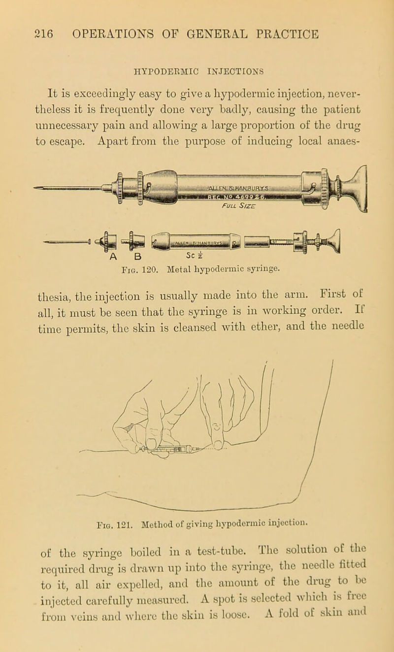 HYPODERMIC INJECTIONS It is exceedingly easy to give a hypodermic injection, never- theless it is frequently done very badly, causing the patient unnecessary pain and allowing a large proportion of the drug to escape. Apart from the purpose of inducing local anaes- Fjg. 120. Metal hypodermic syringe. thesia, the injection is usually made into the arm. First of all, it must be seen that the syringe is in working order. If time permits, the skin is cleansed with ether, and the needle Fig. 121. Method of giving hypodermic injection. of the syringe boiled in a test-tube. The solution of the required drug is drawn up into the syringe, the needle iitted to it, all air expelled, and the amount of the drug to be injected carefully measured. A spot is selected which is fiee from veins and where the skin is loose. A fold of skin and