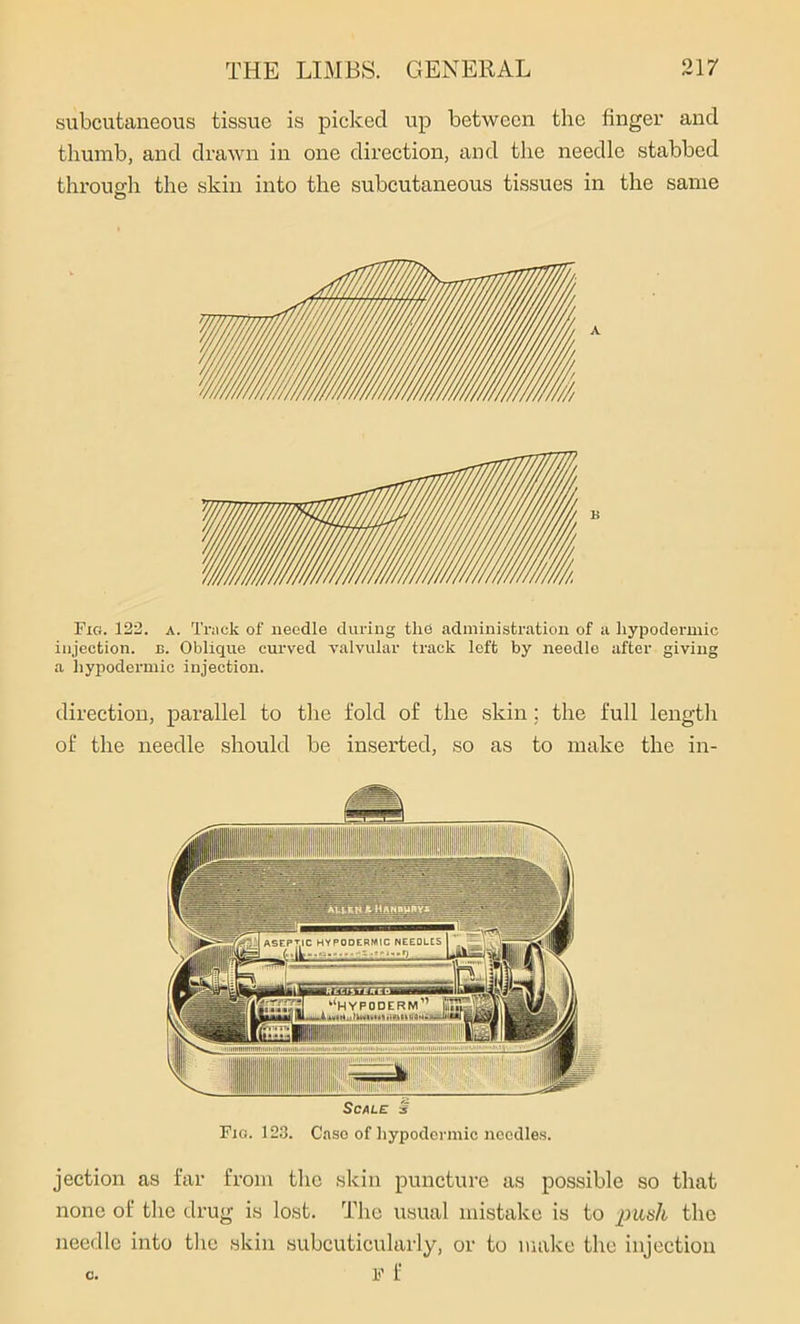 subcutaneous tissue is picked up between the finger and thumb, and drawn in one direction, and the needle stabbed through the skin into the subcutaneous tissues in the same O Fig. 122. a. Track of needle during the administration of a hypodermic injection, b. Oblique curved valvular track left by needle after giving a hypodermic injection. direction, parallel to the fold of the skin ; the full length of the needle should be inserted, so as to make the in- SCALE § Fig. 123. Case of hypodermic needles. jection as far from the skin puncture as possible so that none of the drug is lost. The usual mistake is to -pash the needle into the skin subcuticularly, or to make the injection F f C.