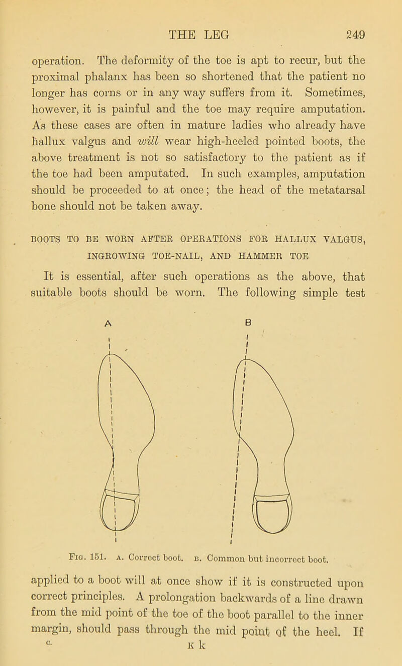 operation. The deformity of the toe is apt to recur, but the proximal phalanx has been so shortened that the patient no longer has corns or in any way suffers from it. Sometimes, however, it is painful and the toe may require amputation. As these cases are often in mature ladies who already have hallux valgus and will wear high-heeled pointed boots, the above treatment is not so satisfactory to the patient as if the toe had been amputated. In such examples, amputation should be proceeded to at once; the head of the metatarsal bone should not be taken away. BOOTS TO BE WORN AFTER OPERATIONS FOR HALLUX VALGUS, INGROWING TOE-NAIL, AND HAMMER TOE It is essential, after such operations as the above, that suitable boots should be worn. The following simple test applied to a boot will at once show if it is constructed upon correct principles. A prolongation backwards of a line drawn from the mid point of the toe of the boot parallel to the inner margin, should pass through the mid point of the heel. If k k