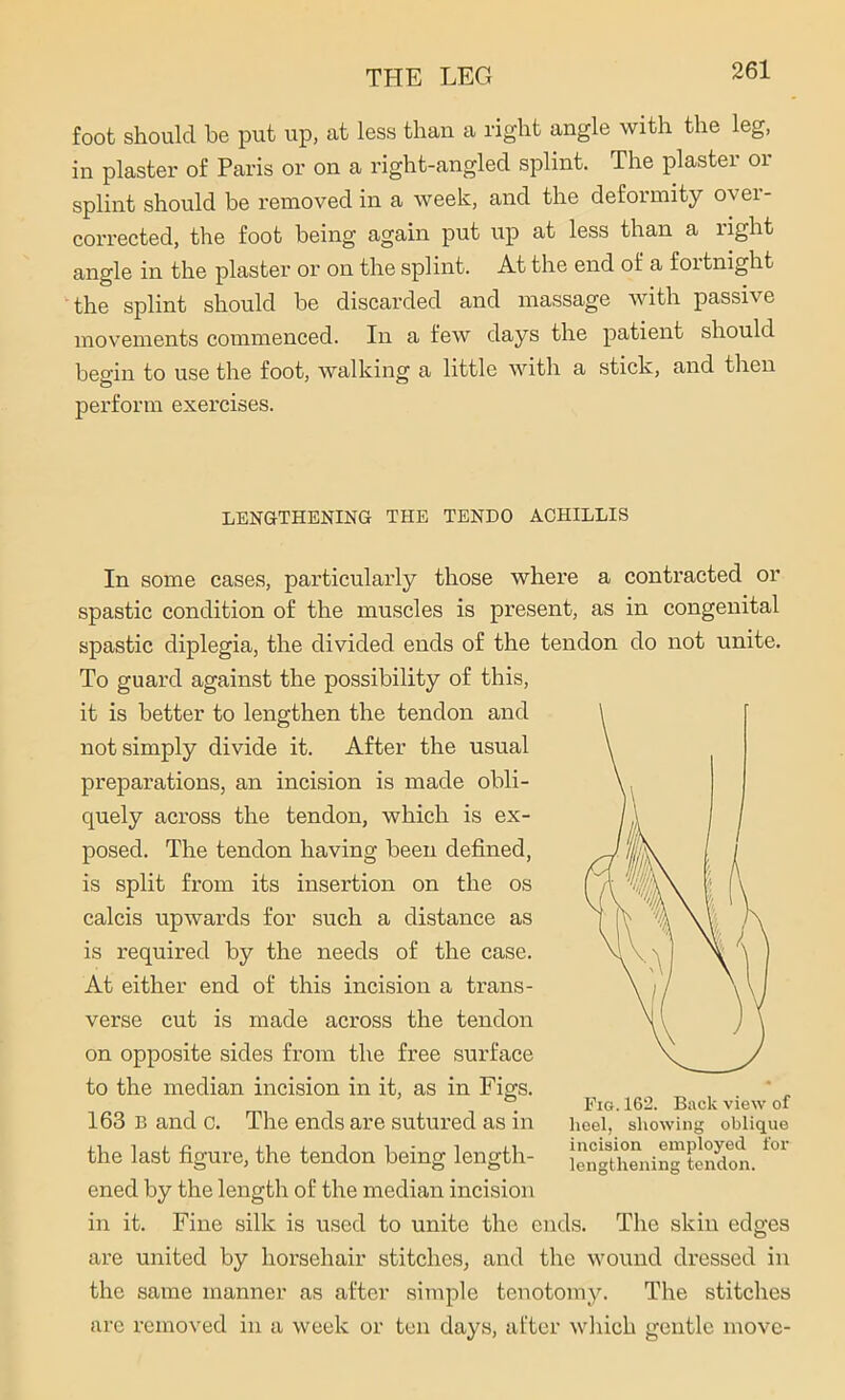 foot should be put up, at less than a right angle with the leg, in plaster of Paris or on a right-angled splint. The plaster or splint should be removed in a week, and the deformity ovei- corrected, the foot being again put up at less than a right angle in the plaster or on the splint. At the end of a fortnight the splint should be discarded and massage with passive movements commenced. In a few days the patient should begin to use the foot, walking a little with a stick, and then perform exercises. LENGTHENING THE TENDO ACHILLIS In some cases, particularly those where a contracted or spastic condition of the muscles is present, as in congenital spastic diplegia, the divided ends of the tendon do not unite. To guard against the possibility of this, it is better to lengthen the tendon and not simply divide it. After the usual preparations, an incision is made obli- quely across the tendon, which is ex- posed. The tendon having been defined, is split from its insertion on the os calcis upwards for such a distance as is required by the needs of the case. At either end of this incision a trans- verse cut is made across the tendon on opposite sides from the free surface to the median incision in it, as in Figs. 163 B and c. The ends are sutured as in the last figure, the tendon being length- ened by the length of the median incision in it. Fine silk is used to unite the ends, are united by horsehair stitches, and the wound dressed in the same manner as after simple tenotomy. The stitches are removed in a week or ten days, after which gentle movc- Fig. 162. Back view of heel, showing oblique incision employed for lengthening tendon. The skin edges