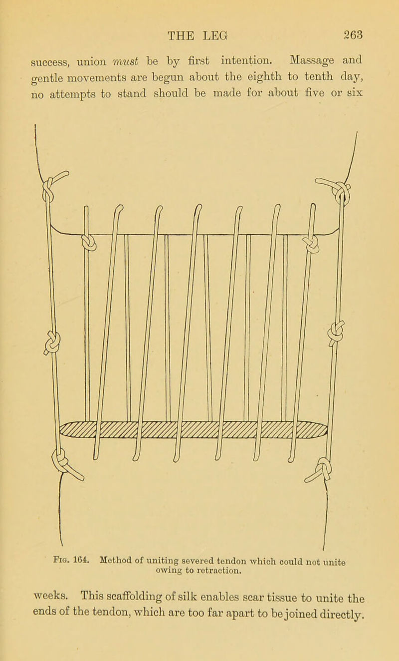 success, union must be by first intention. Massage and o-entle movements are begun about the eighth to tenth day, no attempts to stand should be made for about five or six Fig. 1G4. Method of uniting severed tendon which could not unite owing to retraction. weeks. This scaffolding of silk enables scar tissue to unite the ends of the tendon, which are too far apart to be joined directly.