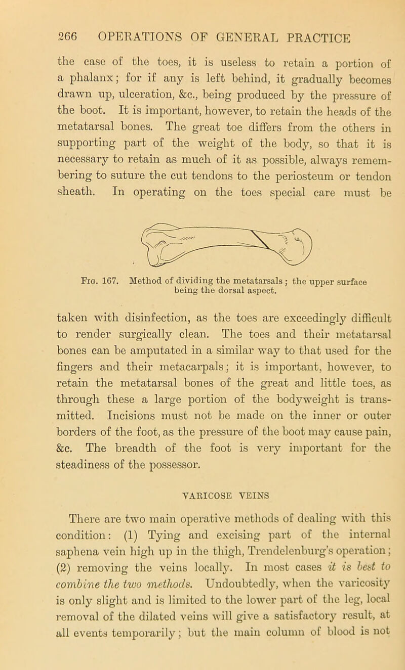 the case of the toes, it is useless to retain a portion of a phalanx; for if any is left behind, it gradually becomes drawn up, ulceration, &c., being produced by the pressure of the boot. It is important, however, to retain the heads of the metatarsal bones. The great toe differs from the others in supporting part of the weight of the body, so that it is necessary to retain as much of it as possible, always remem- bering to suture the cut tendons to the periosteum or tendon sheath. In operating on the toes special care must be Fig. 167. Method of dividing the metatarsals ; the upper surface being the dorsal aspect. taken with disinfection, as the toes are exceedingly difficult to render surgically clean. The toes and their metatarsal bones can be amputated in a similar way to that used for the fingers and their metacarpals; it is important, however, to retain the metatarsal bones of the great and little toes, as through these a large portion of the bodyweight is trans- mitted. Incisions must not be made on the inner or outer borders of the foot, as the pressure of the boot may cause pain, &c. The breadth of the foot is very important for the steadiness of the possessor. There are two main operative methods of dealing with this condition: (1) Tying and excising part of the internal saphena vein high up in the thigh, Trendelenburg’s operation; (2) removing the veins locally. In most cases it is best to combine the two methods. Undoubtedly, when the varicosity is only slight and is limited to the lower part of the leg, local removal of the dilated veins will give a satisfactory result, at all events temporarily; but the main column of blood is not VARICOSE VEINS