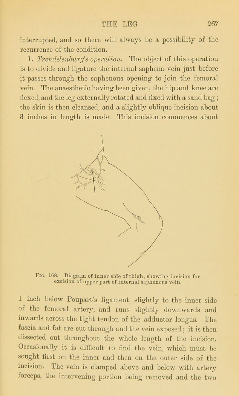 interrupted, and so there will always be a possibility of the recurrence of the condition. 1. Trendelenburg’s operation. The object of this operation is to divide and ligature the internal saphena vein just before it passes through the saphenous opening to join the femoral vein. The anaesthetic having been given, the hip and knee are flexed, and the leg externally rotated and fixed with a sand bag; the skin is then cleansed, and a slightly oblique incision about 3 inches in length is made. This incision commences about Fig. 168. Diagram of inner side of tliigh, showing incision for excision of upper part of internal saphenous vein. 1 inch below Poupart’s ligament, slightly to the inner side of the femoral artery, and runs slightly downwards and inwards across the tight tendon of the adductor longus. The fascia and fat are cut through and the vein exposed; it is then dissected out throughout the whole length of the incision. Occasionally it is difficult to find the vein, which must be sought first on the inner and then on the outer side of the incision. The vein is clamped above and below with artery forceps, the intervening portion being removed and the two