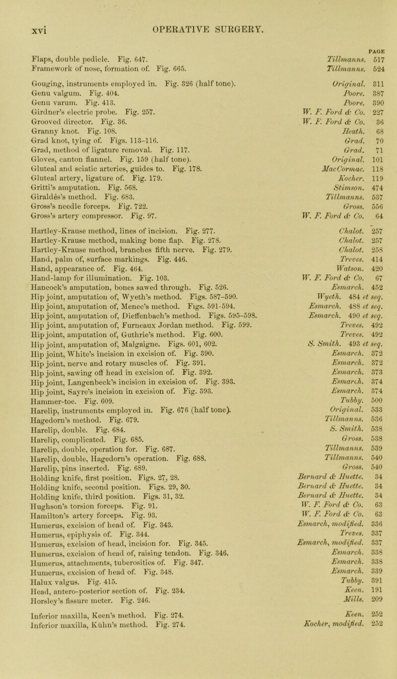 Flaps, double pedicle. Fig. 647. Framework of nose, formation of. Fig. 665. Gouging, instruments employed in. Fig. 326 (half tone). Genu valgum. Fig. 404. Genu varum. Fig. 413. Girdner’s electric probe. Fig. 257. Grooved director. Fig. 36. Granny knot. Fig. 108. Grad knot, tying of. Figs. 113-116. Grad, method of ligature removal. Fig. 117. Gloves, canton flannel. Fig. 159 (half tone). Gluteal and sciatic arteries, guides to. Fig. 178. Gluteal artery, ligature of. Fig. 179. Gritti’s amputation. Fig. 568. Giraldes's method. Fig. 683. Gross’s needle forceps. Fig. 722. Gross’s artery compressor. Fig. 97. Hartley-Krause method, lines of incision. Fig. 277. Hartley-Krause method, making bone flap. Fig. 278. Hartley-Krause method, branches fifth nerve. Fig. 279. Hand, palm of, surface markings. Fig. 446. Hand, appearance of. Fig. 464. Hand-lamp for illumination. Fig. 103. Hancock’s amputation, bones sawed through. Fig. 526. Hip joint, amputation of, Wyeth’s method. Figs. 587-590. Hip joint, amputation of, Menec’s method. Figs. 591-594. Hip joint, amputation of, Hietfenbach’s method. Figs. 595-598. Hip joint, amputation of, Furneaux Jordan method. Fig. 599. Hip joint, amputation of, Guthrie’s method. Fig. 600. Hip joint, amputation of, Malgaigne. Figs. 601, 602. Hip joint, White’s incision in excision of. Fig. 390. Hip joint, nerve and rotary muscles of. Fig. 391. Hip joint, sawing off head in excision of. Fig. 392. Hip joint, Langenbeck’s incision in excision of. Fig. 393. Hip joint, Sayre’s incision in excision of. Fig. 393. Iiammer-toe. Fig. 609. Harelip, instruments employed in. Fig. 676 (halftone). Iiageclorn’s method. Fig. 679. Harelip, double. Fig. 684. Harelip, complicated. Fig. 685. Harelip, double, operation for. Fig. 687. Harelip, double, Hagedorn’s operation. Fig. 688. Harelip, pins inserted. Fig. 689. Holding knife, first position. Figs. 27, 28. Holding knife, second position. Figs. 29, 30. Holding knife, third position. Figs. 31, 32. Hughson’s torsion forceps. Fig. 91. Hamilton’s artery forceps. Fig. 93. Humerus, excision of head of. Fig. 343. Humerus, epiphysis of. Fig. 344. Humerus, excision of head, incision for. Fig. 345. Humerus, excision of head of, raising tendon. Fig. 346. Humerus, attachments, tuberosities of. Fig. 347. Humerus, excision of head of. Fig. 348. Halux valgus. Fig. 415. Head, antero-posterior section of. Fig. 234. Horsley’s fissure meter. Fig. 246. Inferior maxilla, Keen’s method. Fig. 274. Inferior maxilla, Kuhn’s method. Fig. 274. PAGE Tillmanns. 517 Tillmanns. 524 Original. 311 Poore. 387 Poore. 390 W. F. Ford db Co. 227 W. F. Ford db Co. 36 Heath. 68 Grad. 70 Grad. 71 Original. 101 MacCormac. 118 Kocher. 119 Stimson. 474 Tillmanns. 537 Gross. 556 W. F. Ford & Co. 64 Chalot. 257 Chalot. 257 Chalot. 258 Treves. 414 Watson. 420 W. F. Ford db Co. 67 Esmarch. 452 Wyeth. 484 et seq. Esmarch. 488 et seq. Esmarch. 490 et seq. Treves. 492 Treves. 492 S. Smith. 493 et seq. Esmarch. 372 Esmarch. 372 Esmarch. 373 Esmarch. 374 Esmarch. 374 Tubby. 500 Original. 533 Tillmanns. 536 S. Smith. 538 Gross. 538 Tillmanns. 539 Tillmanns. 540 Gross. 540 Bernard & Huette. 34 Bernard tb Huette. 34 Bernard db Huette. 34 W. F. Ford db Co. 63 W. F. Ford & Co. 63 Esmarch, modified. 336 Treves. 337 Esmarch, modified. oo ( Esmarch. 338 Esmarch. 338 Esmarch. 339 Tubby. 391 Keen. 191 Mills. 209 Keen. 252 Kocher, modified. 252