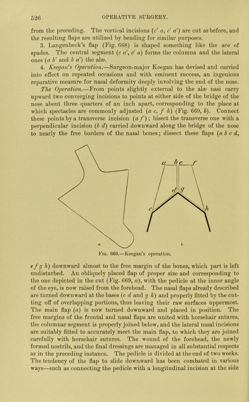 from the preceding. The vertical incisions (d a, d a!) are cut as before, and the resulting flaps are utilized by bending for similar purposes. 3. Langenbeck’s flap (Fig. 668) is shaped something like the ace of spades. The central segment (c ft', d a) forms the columna and the lateral ones (a b' and b a') the alte. 4. Keegan's Operation.—Surgeon-major Keegan has devised and carried into effect on repeated occasions and with eminent success, an ingenious reparative measure for nasal deformity deeply involving the end of the nose. The Operation.—From points slightly external to the alae nasi carry upward two converging incisions to points at either side of the bridge of the nose about three quarters of an inch apart, corresponding to the place at which spectacles are commonly adjusted (a c, f h) (Fig. 669, b). Connect these points by a transverse incision (ft/); bisect the transverse one with a perpendicular incision (b cl) carried downward along the bridge of the nose to nearly the free borders of the nasal bones; dissect these flaps (abed, Fig. 669.—Keegan’s operation. efgh) downward almost to the free margin of the bones, which part is left undisturbed. An obliquely placed flap of proper size and corresponding to the one depicted in the cut (Fig. 669, ft), with the pedicle at the inner angle of the eye, is now raised from the forehead. The nasal flaps already described are turned downward at the bases (c d and g h) and properly fitted by the cut- ting off of overlapping portions, thus leaving their raw surfaces uppermost. The main flap (ft) is now turned downward and placed in position. The free margins of the frontal and nasal flaps are united with horsehair sutures, the columnar segment is properly joined below, and the lateral nasal incisions are suitably fitted to accurately meet the main flap, to which they are joined carefully with horsehair sutures. The wound of the forehead, the newly formed nostrils, and the final dressings are managed in all substantial respects as in the preceding instance. The pedicle is divided at the end of two weeks. The tendency of the flap to slide downward has been combated in various ways—such as connecting the pedicle with a longitudinal incision at the side