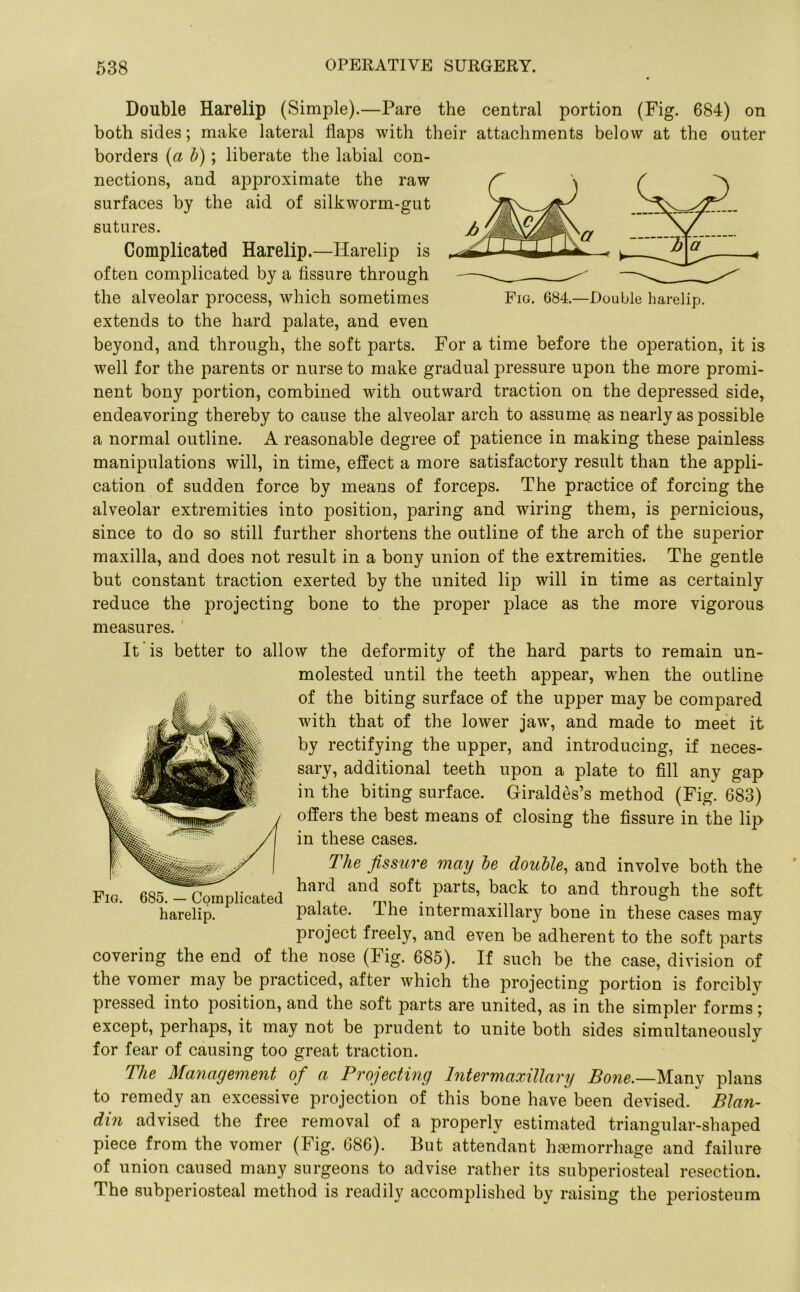 Double Harelip (Simple).—Pare the central portion (Fig. 684) on both sides; make lateral flaps with their attachments below at the outer borders {a h) ; liberate the labial con- nections, and approximate the raw surfaces by the aid of silkworm-gut sutures. Complicated Harelip.—Harelip is often complicated by a fissure through the alveolar process, which sometimes extends to the hard palate, and even beyond, and through, the soft parts. For a time before the operation, it is well for the parents or nurse to make gradual pressure upon the more promi- nent bony portion, combined with outward traction on the depressed side, endeavoring thereby to cause the alveolar arch to assume as nearly as possible a normal outline. A reasonable degree of patience in making these painless manipulations will, in time, effect a more satisfactory result than the appli- cation of sudden force by means of forceps. The practice of forcing the alveolar extremities into position, paring and wiring them, is pernicious, since to do so still further shortens the outline of the arch of the superior maxilla, and does not result in a bony union of the extremities. The gentle but constant traction exerted by the united lip will in time as certainly reduce the projecting bone to the proper place as the more vigorous measures. It is better to allow the deformity of the hard parts to remain un- molested until the teeth appear, when the outline of the biting surface of the upper may be compared with that of the lower jaw, and made to meet it by rectifying the upper, and introducing, if neces- sary, additional teeth upon a plate to fill any gap in the biting surface. Giraldes’s method (Fig. 683) offers the best means of closing the fissure in the lip in these cases. The fissure may he double, and involve both the hard and soft parts, back to and through the soft palate. The intermaxillary bone in these cases may project freely, and even be adherent to the soft parts covering the end of the nose (Fig. 685). If such be the case, division of the vomer may be practiced, after which the projecting portion is forcibly pressed into position, and the soft parts are united, as in the simpler forms j except, perhaps, it may not be prudent to unite both sides simultaneously for fear of causing too great traction. The Management of a Projecting Intermaxillary Bone.—llsmy plans to remedy an excessive projection of this bone have been devised. Blan- din advised the free removal of a properly estimated triangular-shaped piece from the vomer (Fig. 686). But attendant haemorrhage and failure of union caused many surgeons to advise rather its subperiosteal resection. The subperiosteal method is readily accomplished by raising the periosteum Fig. 685. — Complicated harelip.