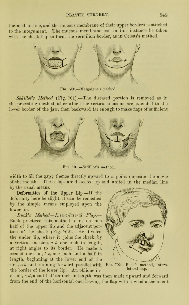 the median line, and the mucous membrane of their upper borders is stitched to the integument. The mucous membrane can in this instance be taken with the cheek flap to form the vermilion border, as in Celsus’s method. Fig. 700.—Malgaigne’s method. Sedillot's Method (Fig. 701).—The diseased portion is removed as in the preceding method, after which the vertical incisions are extended to the lower border of the jaw, then backward far enough to make flaps of sufficient Fig. 701.—Sedillot’s method. width to fill the gap; thence directly upward to a point opposite the angle of the mouth. These flaps are dissected up and united in the median line by the usual means. Deformities of the Upper Lip.—If the deformity here be slight, it can be remedied by the simple means employed upon the lower lip. Buck's Method—Intero-lateral Flap.— Buck practiced this method to restore one half of the upper lip and the adjacent por- tion of the cheek (Fig. 702). He divided the under lip, where it joins the cheek, by a vertical incision, a h, one inch in length, at right angles to its border. lie made a second incision, b c, one inch and a half in length, beginning at the lower end of the first, a by and running forward parallel with the border of the lower lip. An oblique in- cision, c d, about half an inch in length, was then made upward and forward from the end of the horizontal one, leaving the flap with a good attachment Fig. 702.—Buck’s method, intero- lateral flap.