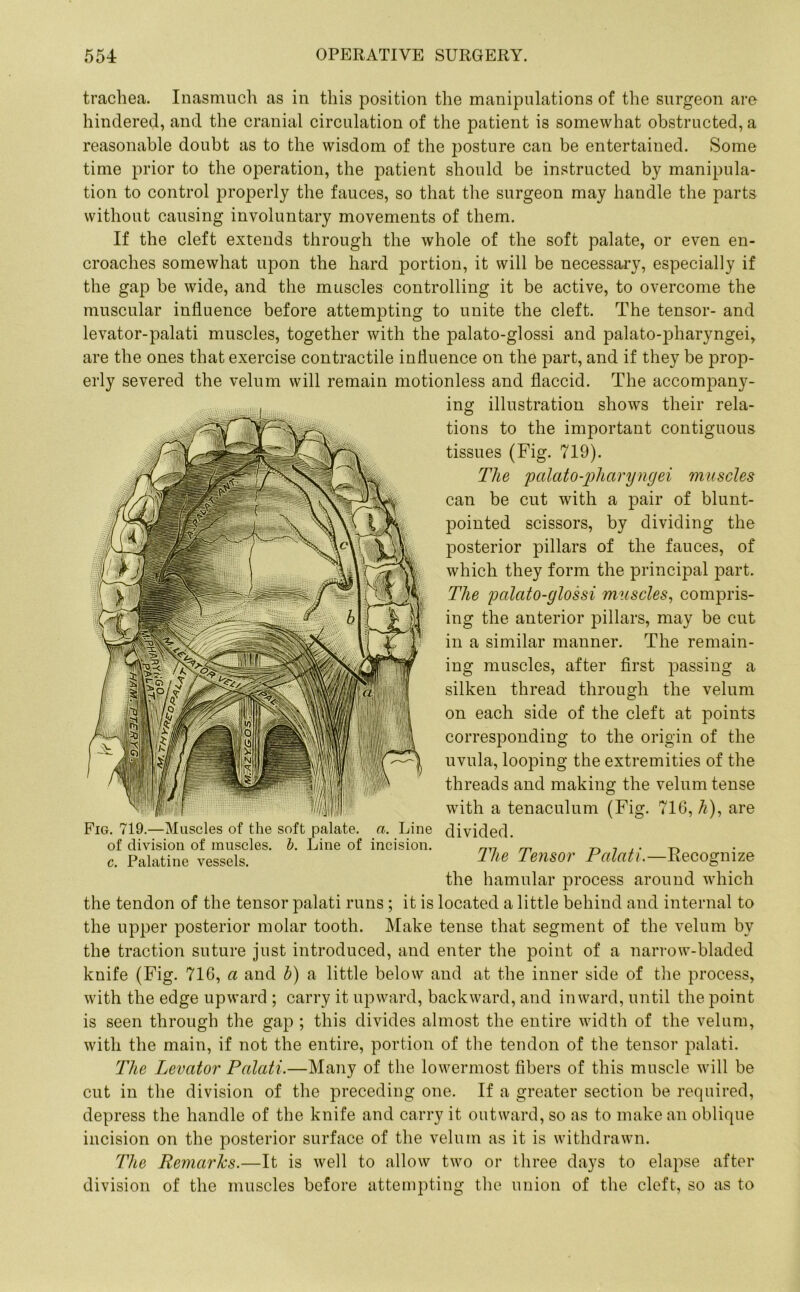 trachea. Inasmuch as in this position the manipulations of the surgeon are hindered, and the cranial circulation of the patient is somewhat obstructed, a reasonable doubt as to the wisdom of the posture can be entertained. Some time prior to the operation, the patient should be instructed by manipula- tion to control properly the fauces, so that the surgeon may handle the parts without causing involuntary movements of them. If the cleft extends through the whole of the soft palate, or even en- croaches somewhat upon the hard portion, it will be necessary, especially if the gap be wide, and the muscles controlling it be active, to overcome the muscular influence before attempting to unite the cleft. The tensor- and levator-palati muscles, together with the palato-glossi and palato-pharyngei, are the ones that exercise contractile influence on the part, and if they be prop- erly severed the velum will remain motionless and flaccid. The accompany- ing illustration shows their rela- tions to the important contiguous tissues (Fig. 719). The palato-pharyngei muscles can be cut with a pair of blunt- pointed scissors, by dividing the posterior pillars of the fauces, of which they form the principal part. The pcdato-glossi muscles, compris- ing the anterior pillars, may be cut in a similar manner. The remain- ing muscles, after first passing a silken thread through the velum on each side of the cleft at points corresponding to the origin of the uvula, looping the extremities of the threads and making the velum tense with a tenaculum (Fig. 716, Zi), are Fig. 719.—Muscles of the soft palate, a. Line divided, of division of muscles, b. Line of incision. nn m c. Palatine vessels. ?he Tensor Palati.—Recognize the hamular process around which the tendon of the tensor palati runs; it is located a little behind and internal to the upper posterior molar tooth. Make tense that segment of the velum by the traction suture just introduced, and enter the point of a narrow-bladed knife (Fig. 716, a and h) a little below and at the inner side of the process, with the edge upward ; carry it upward, backward, and inward, until the point is seen through the gap ; this divides almost the entire width of the velum, with the main, if not the entire, portion of the tendon of the tensor palati. The Levator Palati.—Many of the lowermost fibers of this muscle will be cut in the division of the preceding one. If a greater section be required, depress the handle of the knife and carry it outward, so as to make an oblique incision on the posterior surface of the velum as it is withdrawn. The Remarks.—It is well to allow two or three days to elapse after division of the muscles before attempting the union of the cleft, so as to