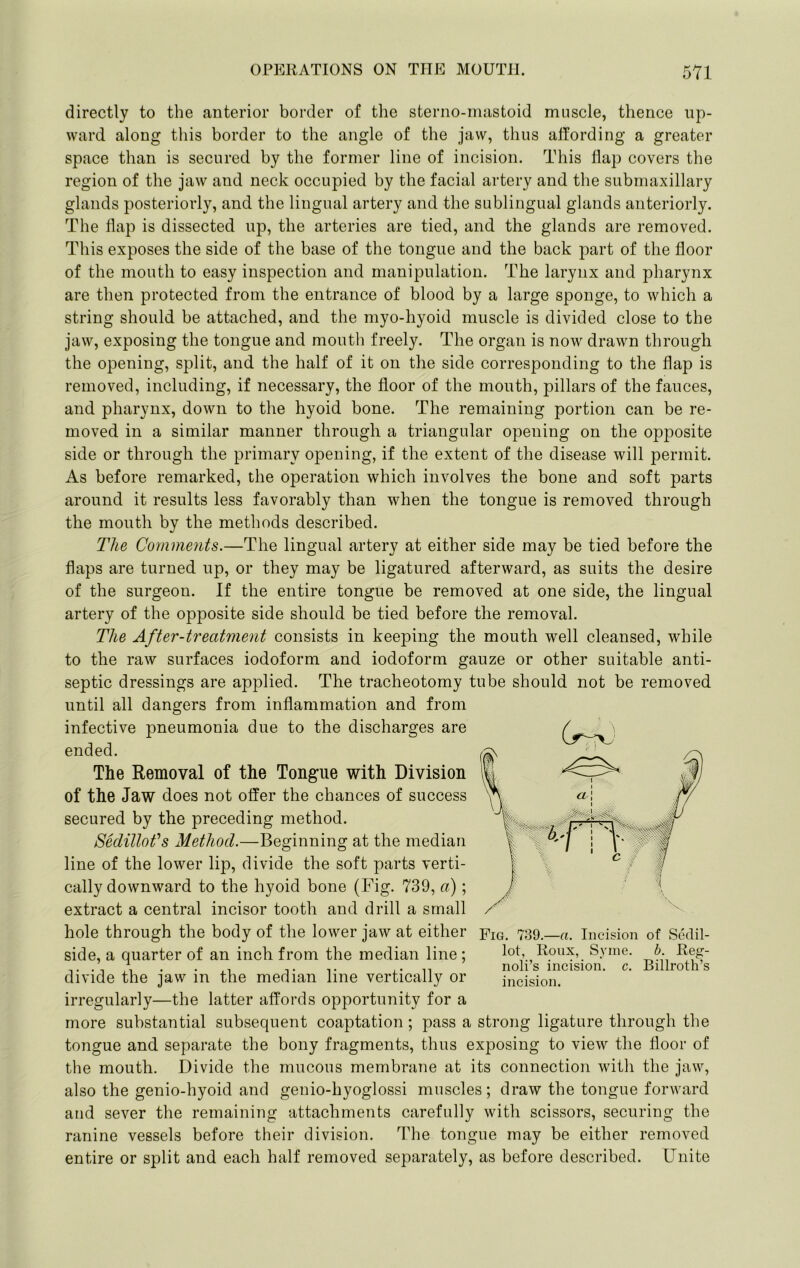 directly to the anterior border of the sterno-mastoid muscle, thence up- ward along this border to the angle of the jaw, thus affording a greater space than is secured by the former line of incision. This flap covers the region of the jaw and neck occupied by the facial artery and the submaxillary glands posteriorly, and the lingual artery and the sublingual glands anteriorly. Tlie flap is dissected up, the arteries are tied, and the glands are removed. This exposes the side of the base of the tongue and the back part of the floor of the mouth to easy inspection and manipulation. The larynx and pharynx are then protected from the entrance of blood by a large sponge, to which a string should be attached, and the myo-hyoid muscle is divided close to the jaw, exposing the tongue and mouth freely. The organ is now drawn through the opening, split, and the half of it on the side corresponding to the flap is removed, including, if necessary, the floor of the mouth, pillars of the fauces, and pharynx, down to the hyoid bone. The remaining portion can be re- moved in a similar manner through a triangular opening on the opposite side or through the primary opening, if the extent of the disease will permit. As before remarked, the operation which involves the bone and soft parts around it results less favorably than when the tongue is removed through the mouth by the methods described. The Comments.—The lingual artery at either side may be tied before the flaps are turned up, or they may be ligatured afterward, as suits the desire of the surgeon. If the entire tongue be removed at one side, the lingual artery of the opposite side should be tied before the removal. The After-treatment consists in keeping the mouth well cleansed, while to the raw surfaces iodoform and iodoform gauze or other suitable anti- septic dressings are applied. The tracheotomy tube should not be removed until all dangers from inflammation and from infective pneumonia due to the discharges are ended. The Removal of the Tongue with Division of the Jaw does not offer the chances of success secured by the preceding method. SedilloCs Method.—Beginning at the median line of the lower lip, divide the soft parts verti- cally downward to the hyoid bone (Fig. 739, a) ; extract a central incisor tooth and drill a small hole through the body of the lower jaw at either Fig. Tdd.—a. Incision of Sedil- side, a quarter of an inch from the median line ; lot, Roux, Syme. b Reg- . . ,, ,. ,• n noli s incision, c. Billroth s divide the jaw in the median line vertically or incision. irregularly—the latter affords opportunity for a more substantial subsequent coaptation; pass a strong ligature through the tongue and separate the bony fragments, thus exposing to view the floor of the mouth. Divide the mucous membrane at its connection witli the jaw, also the genio-hyoid and genio-hyoglossi muscles; draw the tongue forward and sever the remaining attachments carefully with scissors, securing the ranine vessels before their division. The tongue may be either removed entire or split and each half removed separately, as before described. Unite