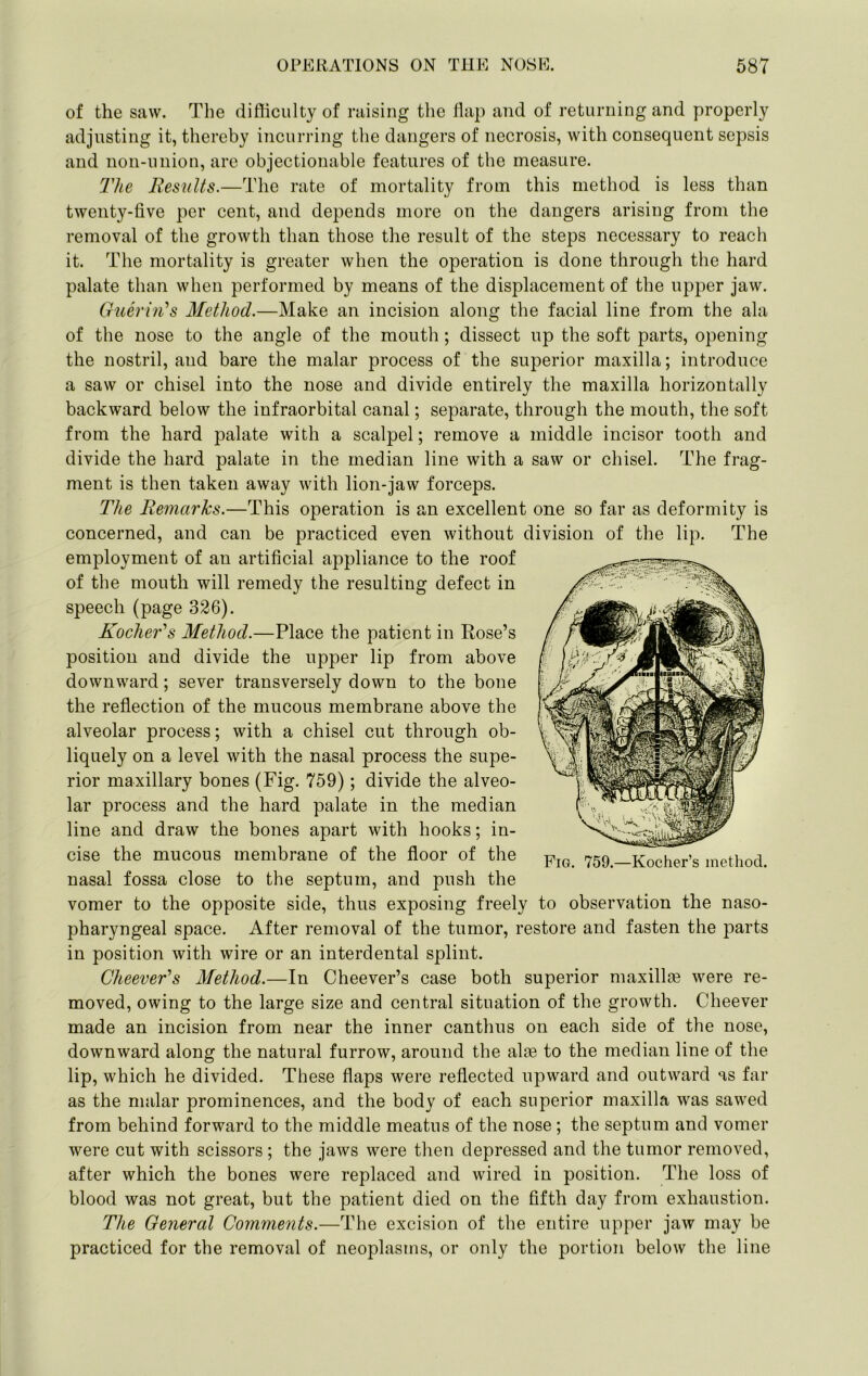 of the saw. The difliculty of raising the flap and of returning and properly adjusting it, thereby incurring the dangers of necrosis, with consequent sepsis and non-union, are objectionable features of the measure. The Results.—The rate of mortality from this method is less than twenty-five per cent, and depends more on the dangers arising from the removal of the growth than those the result of the steps necessary to reach it. The mortality is greater when the operation is done through the hard palate than when performed by means of the displacement of the upper jaw. Gueri)i^s Method.—Make an incision along the facial line from the ala of the nose to the angle of the mouth ; dissect up the soft parts, opening the nostril, and bare the malar process of the superior maxilla; introduce a saw or chisel into the nose and divide entirely the maxilla horizontally backward below the infraorbital canal; separate, through the mouth, the soft from the hard palate with a scalpel; remove a middle incisor tooth and divide the hard palate in the median line with a saw or chisel. The frag- ment is then taken away with lion-jaw forceps. The Remarks.—This operation is an excellent one so far as deformity is concerned, and can be practiced even without division of the lip. The employment of an artificial appliance to the roof of the mouth will remedy the resulting defect in speech (page 326). Kocher^s Method.—Place the patient in Rose’s position and divide the upper lip from above downward; sever transversely down to the bone the refiection of the mucous membrane above the alveolar process; with a chisel cut through ob- liquely on a level with the nasal process the supe- rior maxillary bones (Fig. 759); divide the alveo- lar process and the hard palate in the median line and draw the bones apart with hooks; in- cise the mucous membrane of the floor of the nasal fossa close to the septum, and push the vomer to the opposite side, thus exposing freely to observation the naso- pharyngeal space. After removal of the tumor, restore and fasten the parts in position with wire or an interdental splint. CheeveRs Method.—In Cheever’s case both superior maxillse were re- moved, owing to the large size and central situation of the growth. Cheever made an incision from near the inner canthus on each side of the nose, downward along the natural furrow, around the alae to the median line of the lip, which he divided. These flaps were reflected upward and outward as far as the malar prominences, and the body of each superior maxilla was sawed from behind forward to the middle meatus of the nose ; the septum and vomer were cut with scissors ; the jaws were then depressed and the tumor removed, after which the bones were replaced and wired in position. The loss of blood was not great, but the patient died on the fifth day from exhaustion. The General Comments.—The excision of the entire upper jaw may be practiced for the removal of neoplasms, or only the portion below the line Fig. 759.—Kocher’s method.