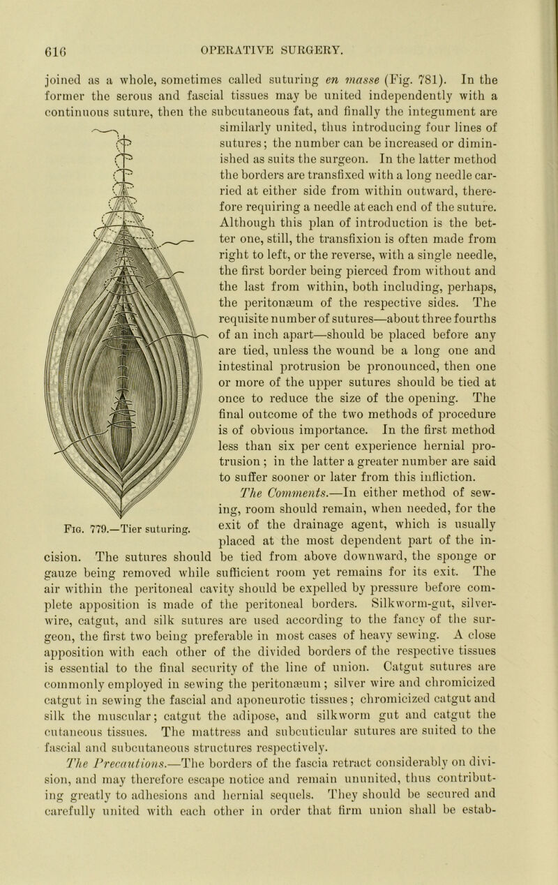 joined as a whole, sometimes called suturing en masse (Fig. 781). In the former the serous and fascial tissues may be united independently with a continuous suture, then the subcutaneous fat, and finally the integument are similarly united, thus introducing four lines of sutures; the number can be increased or dimin- ished as suits the surgeon. In the latter method the borders are transfixed with a long needle car- ried at either side from within outward, there- fore requiring a needle at each end of the suture. Although this plan of introduction is the bet- ter one, still, the transfixion is often made from right to left, or the reverse, with a single needle, the first border being pierced from without and the last from within, both including, perhaps, the peritonaeum of the respective sides. The requisite number of sutures—about three fourths of an inch apart—should be placed before any are tied, unless the wound be a long one and intestinal protrusion be pronounced, then one or more of the upper sutures should be tied at once to reduce the size of the opening. The final outcome of the two methods of procedure is of obvious importance. In the first method less than six per cent experience hernial pro- trusion ; in the latter a greater number are said to sutler sooner or later from this infliction. The Comments.—In either method of sew- ing, room should remain, when needed, for the exit of the drainage agent, which is usually placed at the most dependent part of the in- cision. The sutures should be tied from above downward, the sponge or gauze being removed while sufficient room yet remains for its exit. The air within the peritoneal cavity should be expelled by pressure before com- plete apposition is made of the peritoneal borders. Silkworm-gut, silver- wire, catgut, and silk sutures are used according to the fancy of the sur- geon, the first two being preferable in most cases of heavy sewing. A close apposition with each other of the divided borders of the respective tissues is essential to the final security of the line of union. Catgut sutures are commonly employed in sewing the peritona3um; silver wire and chromicized catgut in sewing the fascial and aponeurotic tissues; chromicized catgut and silk the muscular; catgut the adipose, and silkworm gut and catgut the cutaneous tissues. The mattress and subcuticular sutures are suited to the fascial and subcutaneous structures respectively. The Precautions.—The borders of the fascia retmct considerably on divi- sion, and may therefore escape notice and remain ununited, thus contribut- ing greatly to adhesions and hernial sequels. They should be secured and carefully united with each other in order that firm union shall be estab- Fig. 779.—Tier suturing.