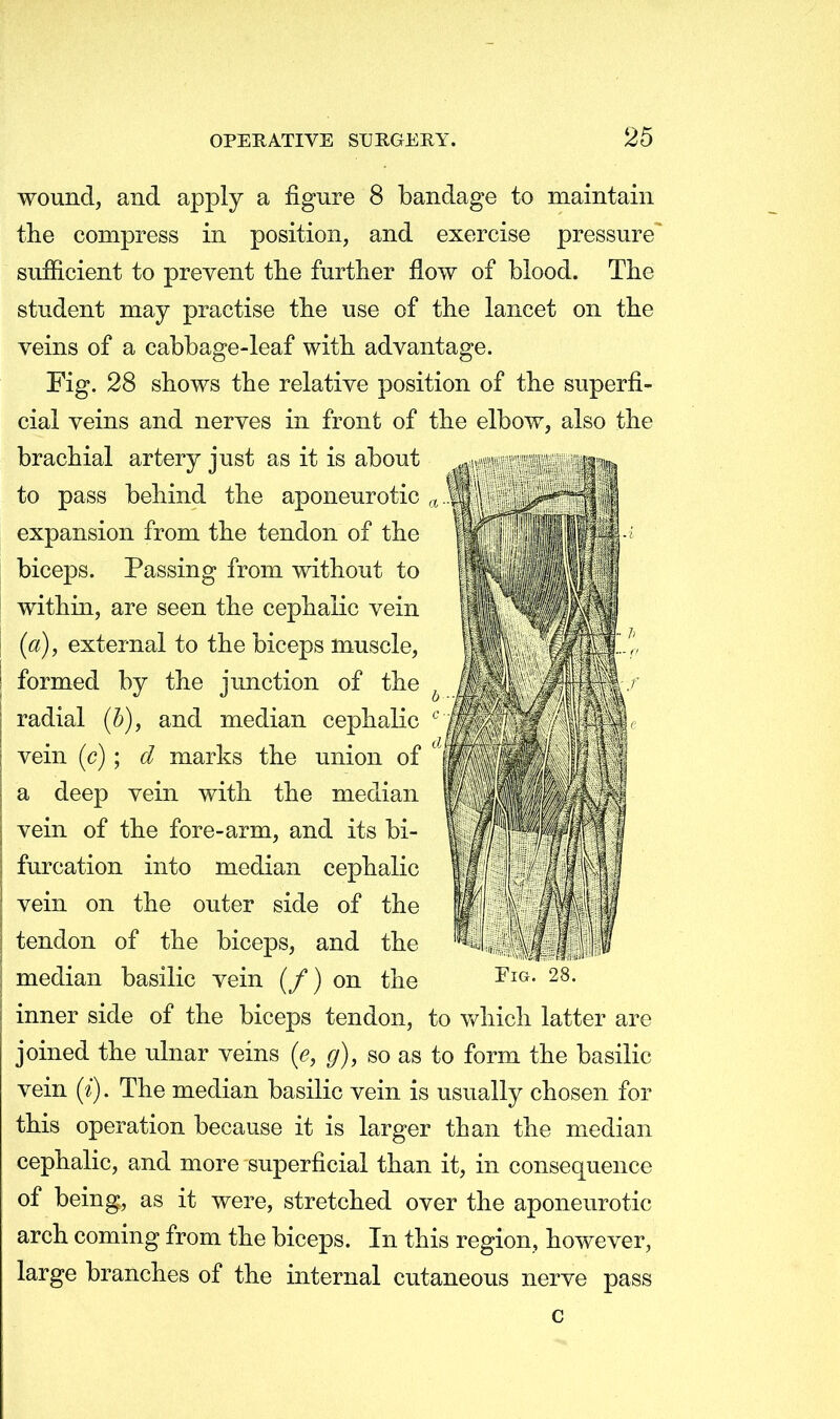 wound, and apply a figure 8 bandage to maintain the compress in position, and exercise pressure' sufficient to prevent the further flow of blood. The student may practise the use of the lancet on the veins of a cabbage-leaf with advantage. Fig. 28 shows the relative position of the superfi- cial veins and nerves in front of the elbow, also the brachial artery just as it is about to pass behind the aponeurotic a expansion from the tendon of the biceps. Passing from without to within, are seen the cephalic vein (a), external to the biceps muscle, formed by the junction of the radial (b), and median cephalic c vein (c) ; d marks the union of d> a deep vein with the median vein of the fore-arm, and its bi- furcation into median cephalic vein on the outer side of the tendon of the biceps, and the median basilic vein (/) on the FlG- 28- inner side of the biceps tendon, to which latter are joined the ulnar veins (e, g), so as to form the basilic vein (i). The median basilic vein is usually chosen for this operation because it is larger than the median cephalic, and more superficial than it, in consequence of being, as it were, stretched over the aponeurotic arch coming from the biceps. In this region, however, large branches of the internal cutaneous nerve pass c