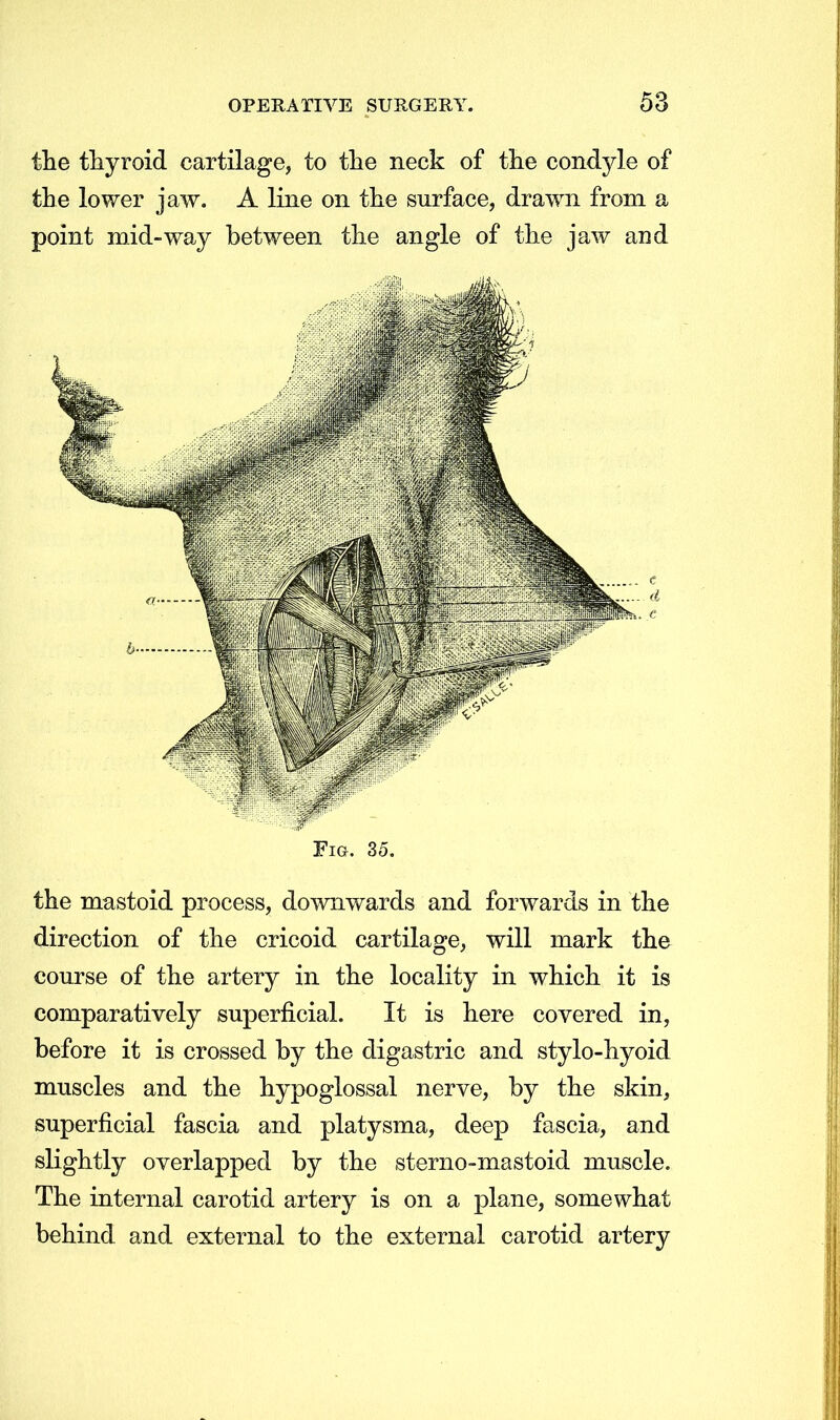 the thyroid cartilage, to the neck of the condyle of the lower jaw. A line on the surface, drawn from a point mid-way between the angle of the jaw and Fig. 35. the mastoid process, downwards and forwards in the direction of the cricoid cartilage, will mark the course of the artery in the locality in which it is comparatively superficial. It is here covered in, before it is crossed by the digastric and stylo-hyoid muscles and the hypoglossal nerve, by the skin, superficial fascia and platysma, deep fascia, and slightly overlapped by the sterno-mastoid muscle. The internal carotid artery is on a plane, somewhat behind and external to the external carotid artery