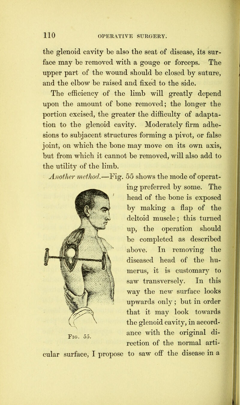 the glenoid cavity be also the seat of disease, its sur- face may be removed with a gouge or forceps. The upper part of the wound should be closed by suture, and the elbow be raised and fixed to the side. The efficiency of the limb will greatly depend upon the amount of bone removed; the longer the portion excised, the greater the difficulty of adapta- tion to the glenoid cavity. Moderately firm adhe- sions to subjacent structures forming a pivot, or false joint, on which the bone may move on its own axis, but from which it cannot be removed, will also add to the utility of the limb. Another method.—Fig. 55 shows the mode of operat- ing preferred by some. The head of the bone is exposed by making a flap of the deltoid muscle; this turned up, the operation should be completed as described above. In removing the diseased head of the hu- merus, it is customary to saw transversely. In this way the new surface looks upwards only ; but in order that it may look towards the glenoid cavity, in accord- ance with the original di- rection of the normal arti- cular surface, I propose to saw olf the disease in a