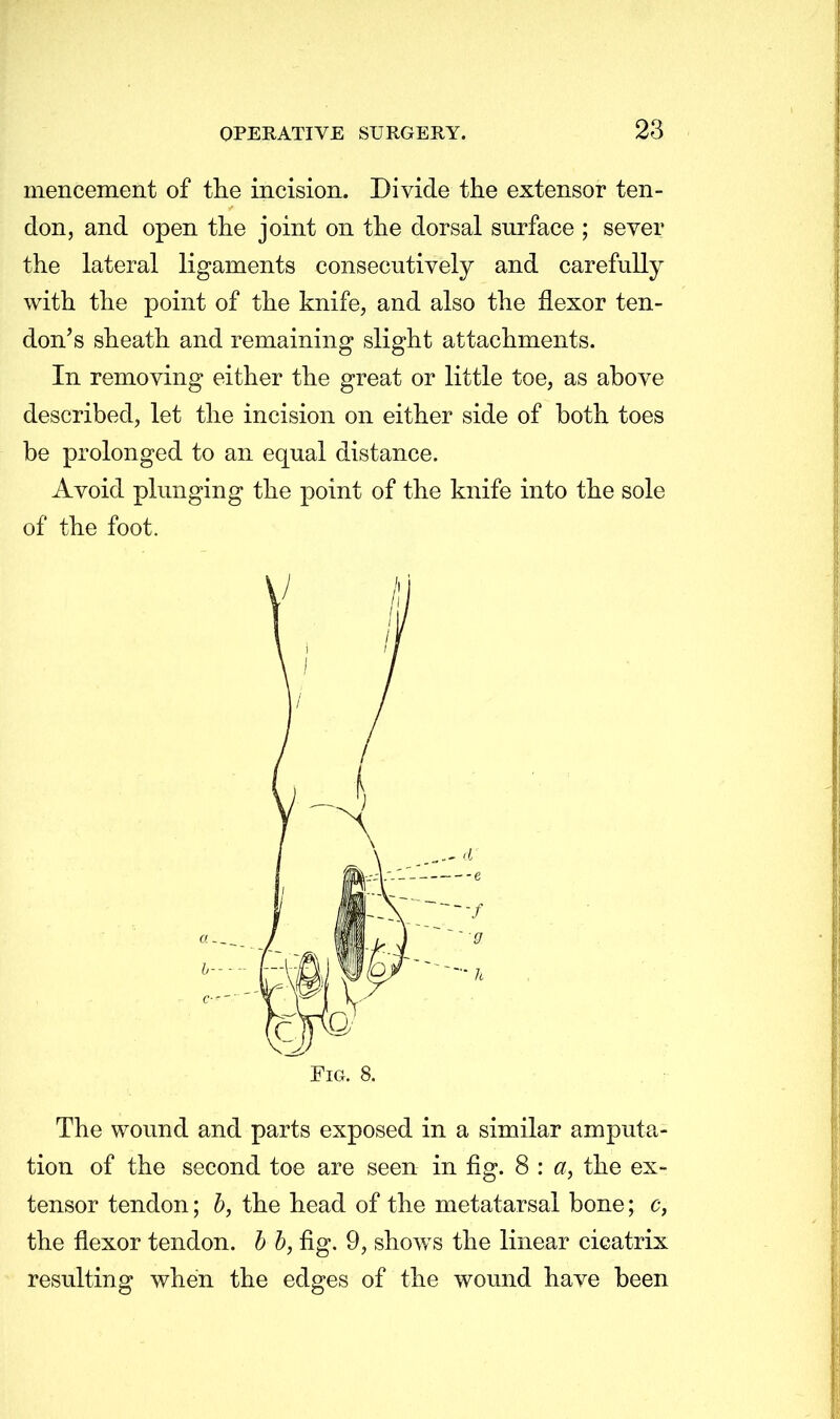 mencement of the incision. Divide the extensor ten- don, and open the joint on the dorsal surface ; sever the lateral ligaments consecutively and carefully with the point of the knife, and also the flexor ten- don's sheath and remaining slight attachments. In removing either the great or little toe, as above described, let the incision on either side of both toes be prolonged to an equal distance. Avoid plunging the point of the knife into the sole of the foot. Fig. 8. The wound and parts exposed in a similar amputa- tion of the second toe are seen in fig. 8 : a, the ex- tensor tendon; b, the head of the metatarsal bone; c, the flexor tendon, b b, fig. 9, shows the linear cicatrix resulting when the edges of the wound have been