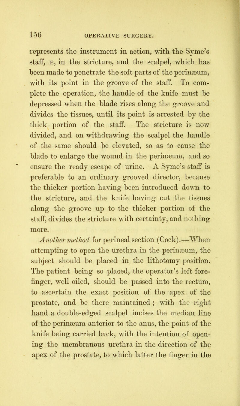 represents the instrument in action, with the Byrne's staff, e, in the stricture, and the scalpel, which has been made to penetrate the soft parts of the perimeum, with its point in the groove of the staff. To com- plete the operation, the handle of the knife must be depressed when the blade rises along the groove and divides the tissues, until its point is arrested by the thick portion of the staff. The stricture is now divided, and on withdrawing the scalpel the handle of the same should be elevated, so as to cause the blade to enlarge the wound in the perinooum, and so ensure the ready escape of urine. A Syme's staff is preferable to an ordinary grooved director, because the thicker portion having been introduced down to the stricture, and the knife having cut the tissues along the groove up to the thicker portion of the staff, divides the stricture with certainty, and nothing more. Another method for perineal section (Cock).—When attempting to open the urethra in the perinscum, the subject should be placed in the lithotomy position. The patient being so placed, the operator's left fore- finger, well oiled, should be passed into the rectum, to ascertain the exact position of the apex of the prostate, and be there maintained ; with the right hand a double-edged scalpel incises the median line of the perinaaum anterior to the anus, the point of the knife being carried back, with the intention of open- ing the membranous urethra in the direction of the apex of the prostate, to which latter the finger in the