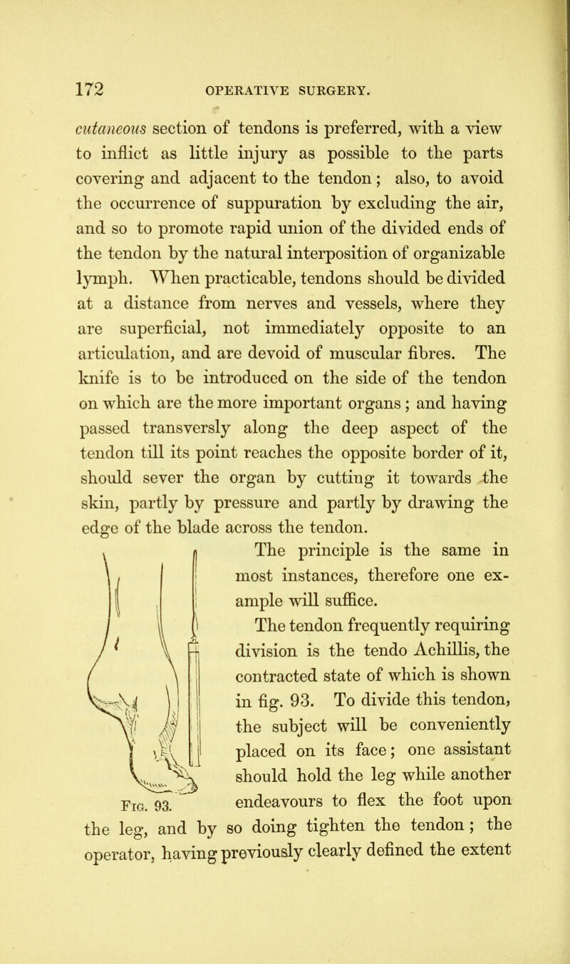 cutaneous section of tendons is preferred, with a view to inflict as little injury as possible to the parts covering and adjacent to the tendon ; also, to avoid the occurrence of suppuration by excluding the air, and so to promote rapid union of the divided ends of the tendon by the natural interposition of organizable lymph. When practicable, tendons should be divided at a distance from nerves and vessels, where they are superficial, not immediately opposite to an articulation, and are devoid of muscular fibres. The knife is to be introduced on the side of the tendon on which are the more important organs ; and having passed transversly along the deep aspect of the tendon till its point reaches the opposite border of it, should sever the organ by cutting it towards the skin, partly by pressure and partly by drawing the edge of the blade across the tendon. I The principle is the same in most instances, therefore one ex- ample will suffice. The tendon frequently requiring division is the tendo Achillis, the contracted state of which is shown in fig. 93. To divide this tendon, the subject will be conveniently placed on its face; one assistant should hold the leg while another endeavours to flex the foot upon the leg, and by so doing tighten the tendon; the operator, having previously clearly defined the extent