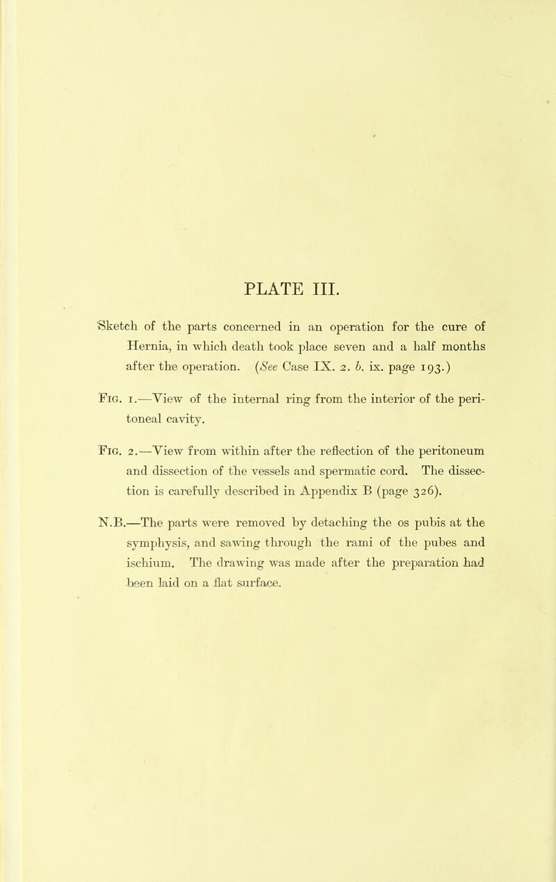 Sketch of tlie parts concerned in an operation for the cure of Hernia, in which death took place seven and a half months after the operation. [See Case IX. 2. 6. ix. page 193.) Fig. I.—Yiew of the internal ring from the interior of the peri- toneal cavity. Fig. 2.—View from within after the reflection of the peritoneum and dissection of tlie vessels and spermatic cord. The dissec- tion is carefully described in Appendix B (page 326). N.B.—The parts were removed by detaching the os pubis at the symphysis, and sawing through the rami of the pubes and ischium. The drawing was made after the preparation had been laid on a flat surface.