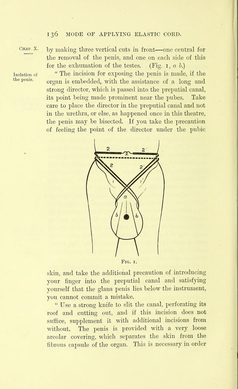 Chap. X. i^y making three vertical cuts in front—one central for the removal of the penis, and one on each side of this for the exhumation of the testes. (Fig. i, a h.) Isolation of  The incision for exposing the penis is made, if the the penis. organ is embedded, with the assistance of a long and strong director, which is passed into the preputial canal, its point being made prominent near the pubes. Take care to place the director in the preputial canal and not in the urethra, or else, as happened once in this theatre, the penis may be bisected. If you take the precaution of feeling the point of the director under the pubic Fig. I. skin, and take the additional precaution of introducing your finger into the preputial canal and satisfying yourself that the glans penis lies below the instrument, you cannot commit a mistake.  Use a strong knife to slit the canal, perforating its roof and cutting out, and if this incision does not suffice, supplement it with additional incisions from without. The penis is provided with a very loose areolar covering, which separates the skin from the fibrous capsule of the organ. This is necessary in order