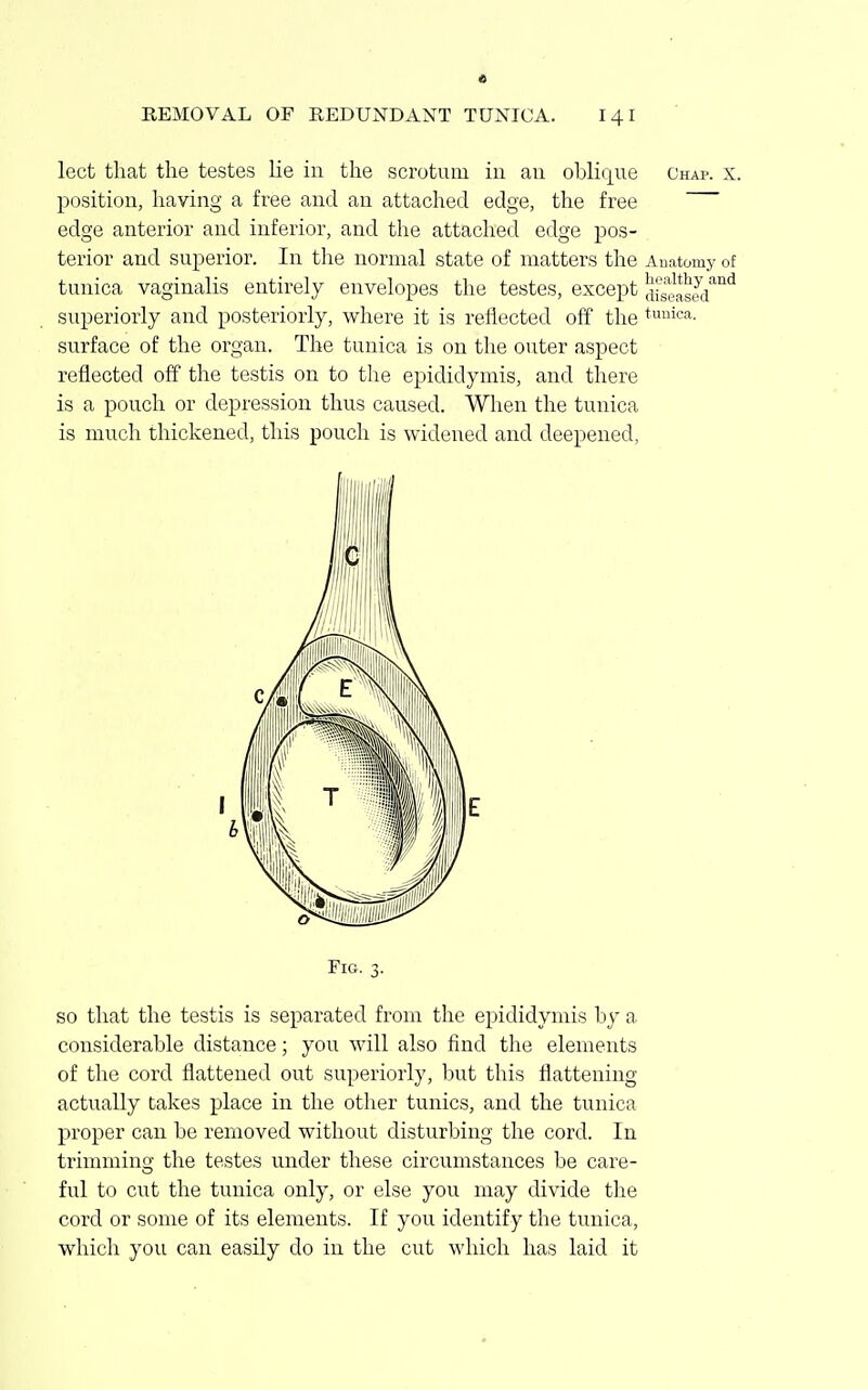 lect that the testes he in the scrotum in an oblique Chap. x. position, having a free and an attached edge, the free edge anterior and inferior, and the attached edge pos- terior and superior. In the normal state of matters the Anatomy of tunica vaginalis entirely envelopes the testes, except dS'seasJ/'^'^ superiorly and posteriorly, where it is reflected off the tunica- surface of the organ. The tunica is on the outer aspect reflected off the testis on to the epididymis, and there is a pouch or depression thus caused. When the tunica is much thickened, this pouch is widened and deepened, Fig. 3. so that the testis is separated from the epididymis by a considerable distance; you Avill also find the elements of the cord flattened out superiorly, but this flattening actually takes place in the other tunics, and the tunica proper can be removed without disturbing the cord. In trimming the testes under these circumstances be care- ful to cut the tunica only, or else you may divide tlie cord or some of its elements. If you identify the tunica, which you can easily do in the cut which has laid it