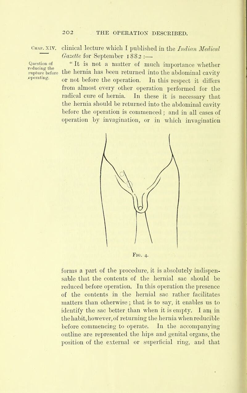 Chap. XIV. clinical lecture which I published in the Indian Medical Gazette for September 1882 :— Question of  It is not a matter of much importance whether rupture before the hernia has been returned into the abdominal cavity operating. ^^^^ before the operation. In this respect it differs from almost every other operation performed for the radical cure of hernia. In these it is necessary that the hernia should be returned into the abdominal cavity before the operation is commenced; and in all cases of operation by invagination, or in which invagination Fig. 4. forms a part of the procedure, it is absolutely indispen- sable that the contents of the hernial sac should be reduced before operation. In this operation the presence of the contents in the hernial sac rather facilitates matters than otherwise; that is to say, it enables us to identify the sac better than when it is empty. I am in the habit, however, of returning the hernia when reducible before commencing to operate. In the accompanying outline are represented the hips and genital organs, the position of the external or superficial ring, and that