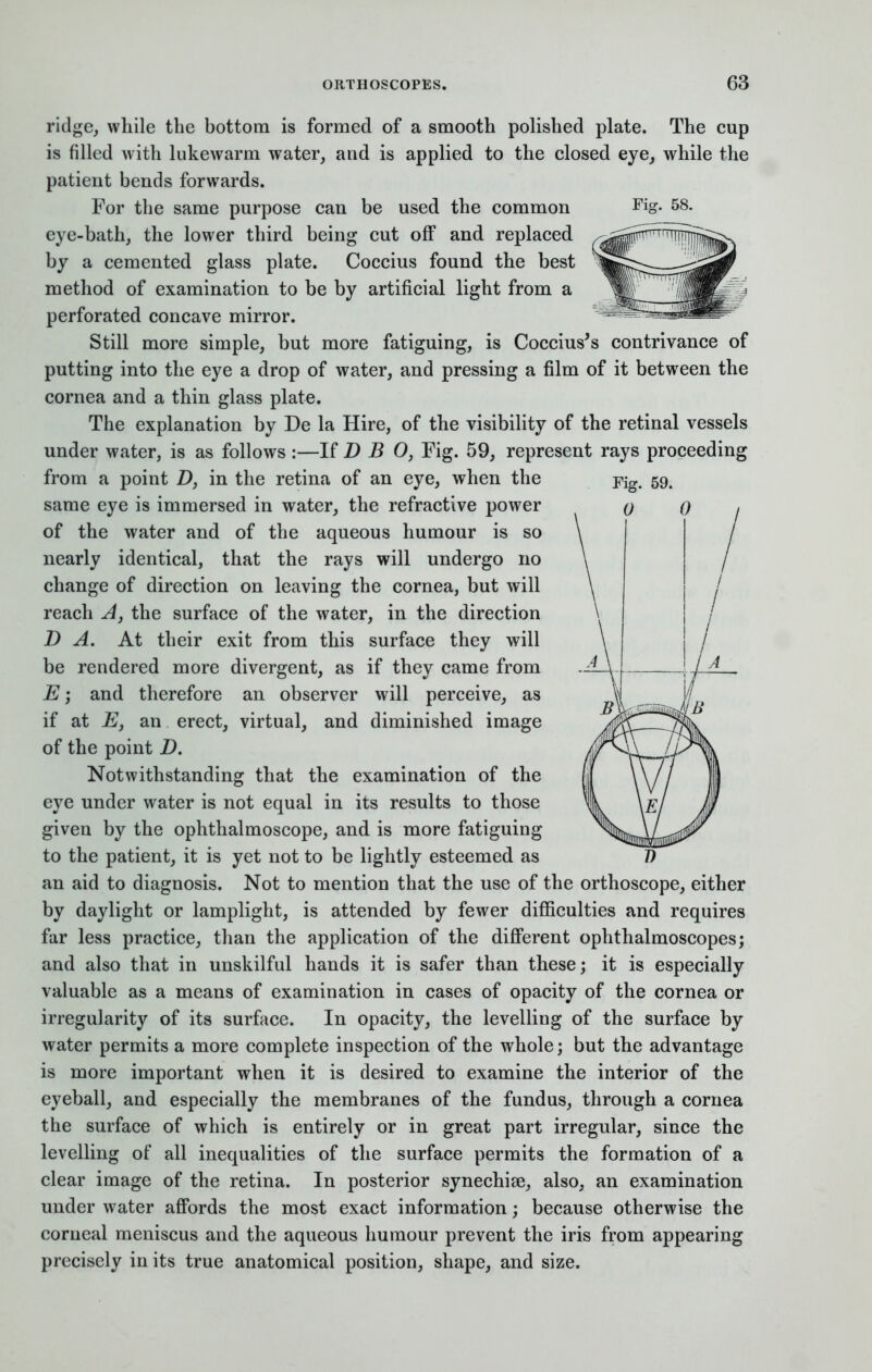 ridge, while the bottom is formed of a smooth polished plate. The cup is filled with lukewarm water, and is applied to the closed eye, while the patient bends forwards. For the same purpose can be used the common Fig- 58. eye-bath, the lower third being cut off and replaced by a cemented glass plate. Coccius found the best method of examination to be by artificial light from a perforated concave mirror. Still more simple, but more fatiguing, is Coccius's contrivance of putting into the eye a drop of water, and pressing a film of it between the cornea and a thin glass plate. The explanation by De la Hire, of the visibility of the retinal vessels under water, is as follows :—If D B 0, Fig. 59, represent rays proceeding from a point Z), in the retina of an eye, when the -pig. 59. same eye is immersed in water, the refractive power of the water and of the aqueous humour is so nearly identical, that the rays will undergo no change of direction on leaving the cornea, but will reach A, the surface of the water, in the direction D A. At their exit from this surface they will be rendered more divergent, as if they came from E; and therefore an observer will perceive, as if at E} an erect, virtual, and diminished image of the point D. Notwithstanding that the examination of the eye under water is not equal in its results to those given by the ophthalmoscope, and is more fatiguing to the patient, it is yet not to be lightly esteemed as an aid to diagnosis. Not to mention that the use of the orthoscope, either by daylight or lamplight, is attended by fewer difficulties and requires far less practice, than the application of the different ophthalmoscopes; and also that in unskilful hands it is safer than these; it is especially valuable as a means of examination in cases of opacity of the cornea or irregularity of its surface. In opacity, the levelling of the surface by water permits a more complete inspection of the whole; but the advantage is more important when it is desired to examine the interior of the eyeball, and especially the membranes of the fundus, through a cornea the surface of which is entirely or in great part irregular, since the levelling of all inequalities of the surface permits the formation of a clear image of the retina. In posterior synechia?, also, an examination under water affords the most exact information; because otherwise the corneal meniscus and the aqueous humour prevent the iris from appearing precisely in its true anatomical position, shape, and size.