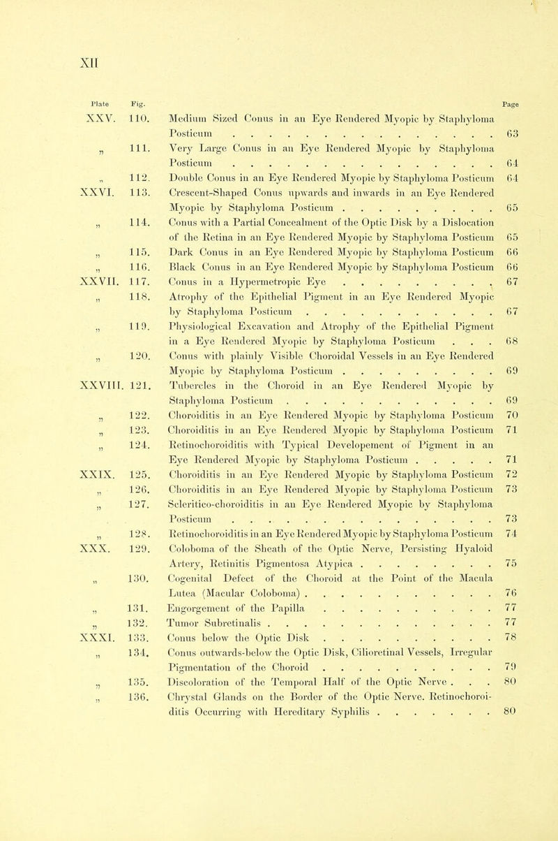 Plate Fig. Page XXV. 110. Medium Sized Conns in an Eye Rendered Myopic by Staphyloma, Posticum 63 „ 111. Very Large Conus in an Eye Rendered Myopic by Staphyloma Posticum 64 „ 112. Double Conus in an Eye Rendered Myopic by Staphyloma Posticum 64 XXVI. 113. Crescent-Shaped Conus upwards and inwards in an Eye Rendered Myopic by Staphyloma Posticum 65 „ 114. Conus with a Partial Concealment of the Optic Disk by a Dislocation of the Retina in an Eye Rendered Myopic by Staphyloma Posticum 65 „ 115. Dark Conus in an Eye Rendered Myopic by Staphyloma Posticum 66 „ 116. Black Conus in an Eye Rendered Myopic by Staphyloma Posticum 66 XXVII. 117. Conus in a Hypermetropic Eye 67 ,, 118. Atrophy of the Epithelial Pigment in an Eye Rendered Myopic by Staphyloma Posticum 67 „ 119. Physiological Excavation and Atrophy of the Epithelial Pigment, in a Eye Rendered Myopic by Staphyloma Posticum . . . 68 „ 120. Conus with plainly Visible Choroidal Vessels in an Eye Rendered Myopic by Staphyloma Posticum 69 XXVIII. 121. Tubercles in the Choroid in an Eye Rendereil Myopic by Staphyloma Posticum . . . 69 n 122. Choroiditis in an Eye Rendered Myopic by Staphyloma Posticum 70 „ 123. Choroiditis in an Eye Rendered Myopic by Staphyloma Posticum 71 „ 124. Retinochoroiditis with Typical Developement of Pigment in an Eye Rendered Myopic by Staphyloma Posticum 71 XXIX. 125. Choroiditis in an Eye Rendered Myopic by Staphyloma Posticum 72 „ 126. Choroiditis in an Eye Rendered Myopic by Staphyloma Posticum 73 „ 127. Scleritico-choroiditis in an Eye Rendered Myopic by Staphyloma Posticum 73 „ 128. Retinochoroiditis in an Eye Rendered Myopic by Staphyloma Posticum 74 XXX. 129. Coloboma of the Sheath of the Optic Nerve, Persisting Hyaloid Artery, Retinitis Pigmentosa Atypica 75 „ 130. Cogenital Defect of the Choroid at the Point of the Macula Lutea (Macular Coloboma) 76 „ 131. Engorgement of the Papilla 77 „ 132. Tumor Subretinalis 77 XXXI. 133. Conus below the Optic Disk 78 „ 134. Conus outwards-below the Optic Disk, Cilioretinal Vessels, Irregular Pigmentation of the Choroid 79 „ 135. Discoloration of the Temporal Half of the Optic Nerve ... 80 „ 136. Chrystal Glands on the Border of the Optic Nerve. Retinochoroi- ditis Occurring with Hereditary Syphilis 80