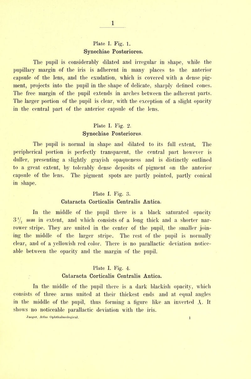 Plate I. Fig. 1. Synechiae Posteriores. The pupil is considerably dilated and irregular in shape, while the pupillary margin of the iris is adherent in many places to the anterior capsule of the lens, and the exudation, which is covered with a dense pig- ment, projects into the pupil in the shape of delicate, sharply defined cones. The free margin of the pupil extends in arches between the adherent parts. The larger portion of the pupil is clear, with the exception of a slight opacity in the central part of the anterior capsule of the lens. Plate I. Fig. 2. Synechiae Posteriores The pupil is normal in shape and dilated to its full extent. The peripheric^ portion is perfectly transparent, the central part however is duller, presenting a slightly grayish opaqueness and is distinctly outlined to a great extent, by tolerably dense deposits of pigment on the anterior capsule of the lens. The pigment spots are partly pointed, partly conical in shape. Plate I. Fig. 3. Cataracta Corticalis Centralis Antica. In the middle of the pupil there is a black saturated opacity 3'/> mm in extent, and which consists of a long thick and a shorter nar- rower stripe. They are united in the center of the pupil, the smaller join- ing the middle of the larger stripe. The rest of the pupil is normally clear, and of a yellowish red color. There is no parallactic deviation notice- able between the opacity and the margin of the pupil. Plate I. Fig. 4. Cataracta Corticalis Centralis Antica. In the middle of the pupil there is a dark blackish opacity, which consists of three arms united at their thickest ends and at equal angles in the middle of the pupil, thus forming a figure like an inverted A. It shows no noticeable parallactic deviation with the iris. Jaeger, Atlas Ophthalraological. 1