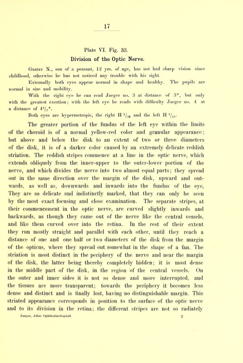 Plate VI. Fig. 33. Division of the Optic Nerve. Griistav N., son of a peasant, 12 yrs. of age, has not had sharp vision since childhood, otherwise he has not noticed any trouble with his sight. Externally both eyes appear normal in shape and healthy. The pupils are normal in size and mobility. With the right eye he can read Jaeger no. 3 at distance of 3, but only with the greatest exertion; with the left eye he reads with difficulty Jaeger no. 4 at a distance of 41/,,. Both eyes are hypermetropic, the right H 1/30 and the left H The greater portion of the fundus of the left eye within the limits of the choroid is of a normal yellow-red color and granular appearance; but above and below the disk to an extent of two or three diameters of the disk, it is of a darker color caused by an extremely delicate reddish striation. The reddish stripes commence at a line in the optic nerve, which extends obliquely from the inner-upper to the outer-lower portion of the nerve, and which divides the nerve into two almost equal parts; they spread out in the same direction over the margin of the disk, upward and out- wards, as well as, downwards and inwards into the fundus of the eye. They are so delicate and indistinctly marked, that they can only be seen by the most exact focusing and close examination. The separate stripes, at their commencement in the optic nerve, are curved slightly inwards and backwards, as though they came out of the nerve like the central vessels, and like them curved over into the retina. In the rest of their extent they run mostly straight and parallel with each other, until they reach a distance of one and one half or two diameters of the disk from the margin of the opticus, where they spread out somewhat in the shape of a fan. The striation is most distinct in the periphery of the nerve and near the margin of the disk, the latter being thereby completely hidden; it is most dense in the middle part of the disk, in the region of the central vessels. On the outer and inner sides it is not so dense and more interrupted, and the tissues are more transparent; towards the periphery it becomes less dense and distinct and is finally lost, having no distinguishable margin. This striated appearance corresponds in position to the surface of the optic nerve and to its division in the retina; the different stripes are not so radiately Jaeger, Atlas Ophthalmological. 3