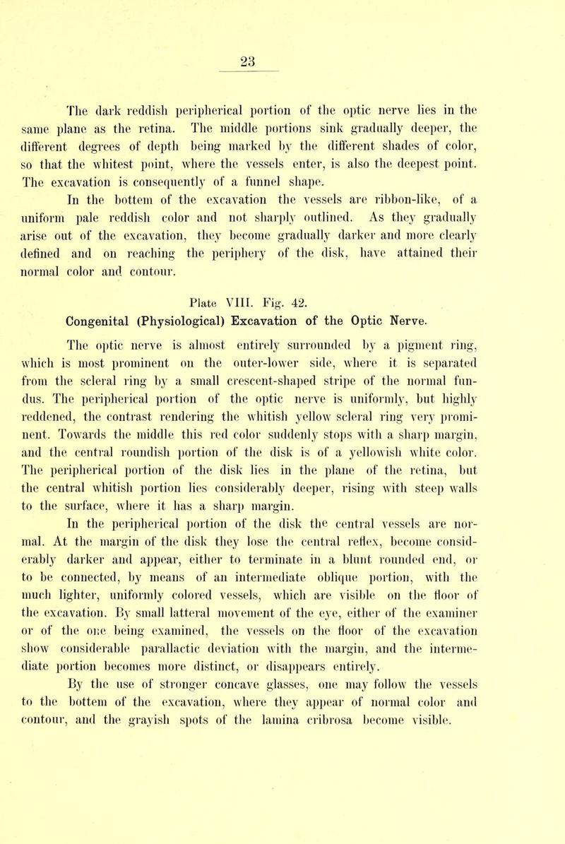 The dark reddish peripherical portion of the optic nerve lies in the same plane as the retina. The middle portions sink gradually deeper, the different degrees of depth being marked by the different shades of color, so that the whitest point, where the vessels enter, is also the deepest point. The excavation is consequently of a funnel shape. In the bottem of the excavation the vessels are ribbon-like, of a uniform pale reddish color and not sharply outlined. As they gradually arise out of the excavation, they become gradually darker and more clearly defined and on reaching the periphery of the disk, have attained their normal color and contour. Plate VIII. Fig. 42. Congenital (Physiological) Excavation of the Optic Nerve. The optic nerve is almost entirely surrounded by a pigment ring, which is most prominent on the outer-lower side, where it is separated from the scleral ring by a small crescent-shaped stripe of the normal fun- dus. The peripherical portion of the optic nerve is uniformly, but highly reddened, the contrast rendering the whitish yellow scleral ring very promi- nent. Towards the middle this red color suddenly stops with a sharp margin, and the central roundish portion of the disk is of a yellowish white color. The peripherical portion of the disk lies in the plane of the retina, but the central whitish portion lies considerably deeper, rising with steep walls to the surface, where it has a sharp margin. In the peripherical portion of the disk the central vessels are nor- mal. At the margin of the disk they lose the central reflex, become consid- erably darker and appear, either to terminate in a blunt rounded end, or to be connected, by means of an intermediate oblique portion, with the much lighter, uniformly colored vessels, which are visible on the floor of the excavation. By small latteral movement of the eye, either of the examiner or of the one being examined, the vessels on the floor of the excavation show considerable parallactic deviation with the margin, and the interme- diate portion becomes more distinct, or disappears entirely. By the use of stronger concave glasses, one may follow the vessels to the bottem of the excavation, where they appear of normal color and contour, and the grayish spots of the lamina cribrosa become visible.