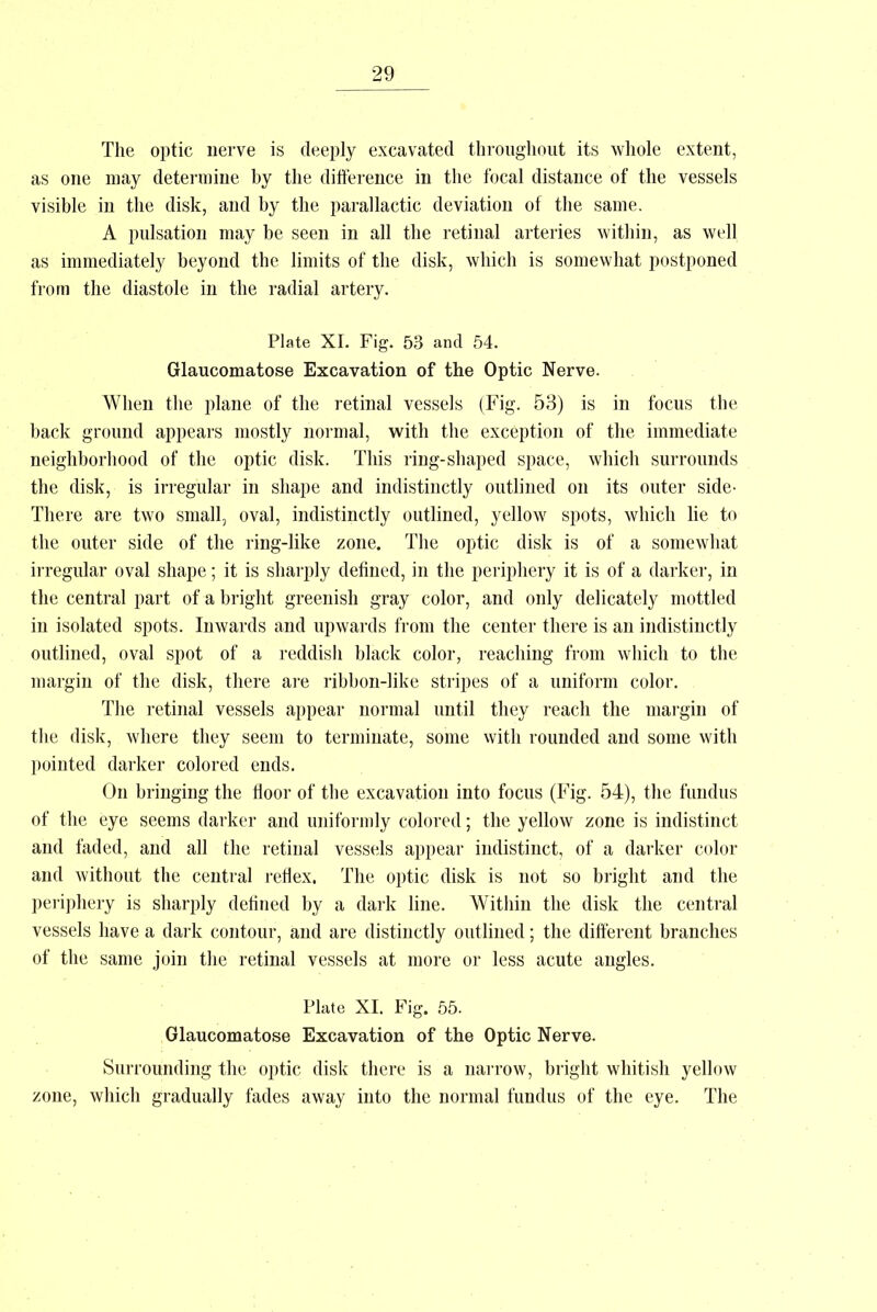 The optic nerve is deeply excavated throughout its whole extent, as one may determine by the difference in the focal distance of the vessels visible in the disk, and by the parallactic deviation of the same. A pulsation may be seen in all the retinal arteries within, as well as immediately beyond the limits of the disk, which is somewhat postponed from the diastole in the radial artery. Plate XI. Fig. 53 and 54. Glaucomatose Excavation of the Optic Nerve. When the plane of the retinal vessels (Fig. 53) is in focus the back ground appears mostly normal, with the exception of the immediate neighborhood of the optic disk. This ring-shaped space, which surrounds the disk, is irregular in shape and indistinctly outlined on its outer side- There are two small, oval, indistinctly outlined, yellow spots, which lie to the outer side of the ring-like zone. The optic disk is of a somewhat irregular oval shape; it is sharply defined, in the periphery it is of a darker, in the central part of a bright greenish gray color, and only delicately mottled in isolated spots. Inwards and upwards from the center there is an indistinctly outlined, oval spot of a reddish black color, reaching from which to the margin of the disk, there are ribbon-like stripes of a uniform color. The retinal vessels appear normal until they reach the margin of the disk, where they seem to terminate, some with rounded and some with pointed darker colored ends. On bringing the floor of the excavation into focus (Fig. 54), the fundus of the eye seems darker and uniformly colored; the yellow zone is indistinct and faded, and all the retinal vessels appear indistinct, of a darker color and without the central reflex. The optic disk is not so bright and the periphery is sharply defined by a dark line. Within the disk the central vessels have a dark contour, and are distinctly outlined; the different branches of the same join the retinal vessels at more or less acute angles. Plate XI. Fig. 55. Glaucomatose Excavation of the Optic Nerve. Surrounding the optic disk there is a narrow, bright whitish yellow zone, which gradually fades away into the normal fundus of the eye. The