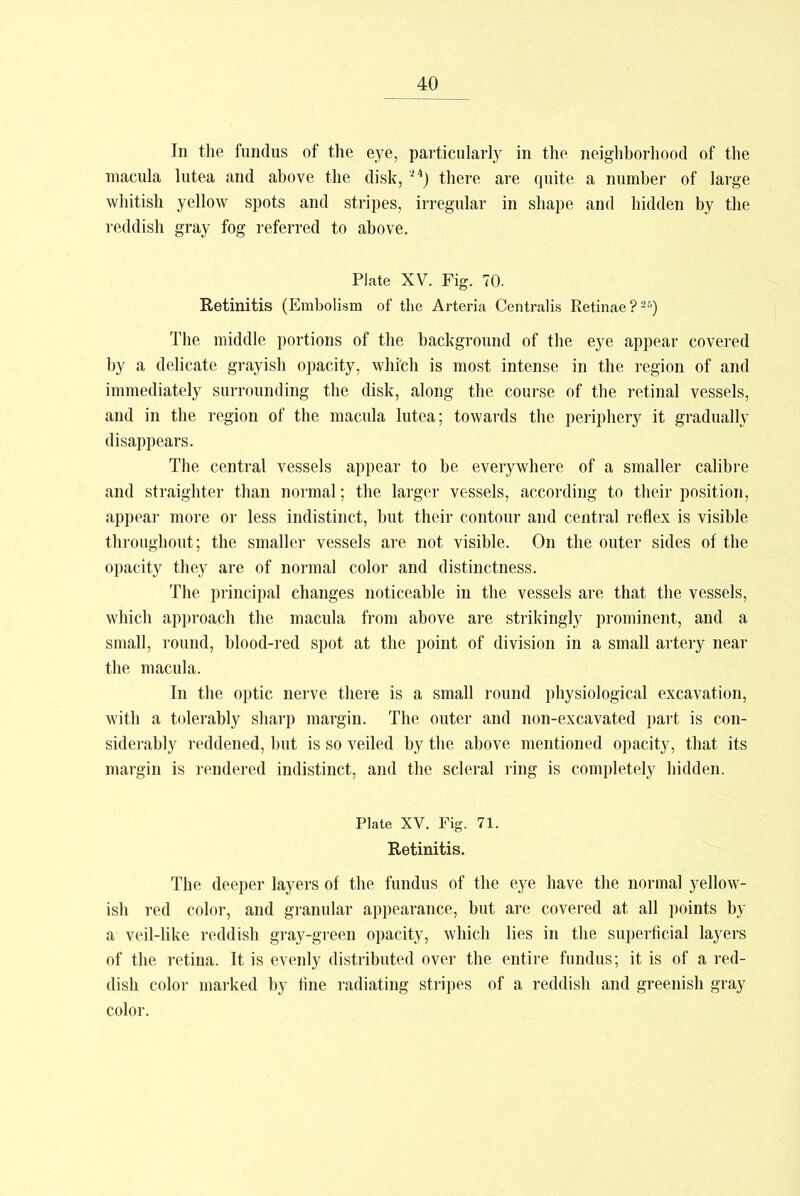 In the fundus of the eye, particularly in the neighborhood of the macula lutea and above the disk, M) there are quite a number of large whitish yellow spots and stripes, irregular in shape and hidden by the reddish gray fog referred to above. Plate XV. Fig. 70. Retinitis (Embolism of the Arteria Centralis Retinae?26) The middle portions of the background of the eye appear covered by a delicate grayish opacity, whi'ch is most intense in the region of and immediately surrounding the disk, along the course of the retinal vessels, and in the region of the macula lutea; towards the periphery it gradually disappears. The central vessels appear to be everywhere of a smaller calibre and straighter than normal; the larger vessels, according to their position, appear more or less indistinct, but their contour and central reflex is visible throughout ; the smaller vessels are not visible. On the outer sides of the opacity they are of normal color and distinctness. The principal changes noticeable in the vessels are that the vessels, which approach the macula from above are strikingly prominent, and a small, round, blood-red spot at the point of division in a small artery near the macula. In the optic nerve there is a small round physiological excavation, with a tolerably sharp margin. The outer and non-excavated part is con- siderably reddened, but is so veiled by the above mentioned opacity, that its margin is rendered indistinct, and the scleral ring is completely hidden. Plate XV. Fig. 71. Retinitis. The deeper layers of the fundus of the eye have the normal yellow- ish red color, and granular appearance, but are covered at all points by a veil-like reddish gray-green opacity, which lies in the superficial layers of the retina. It is evenly distributed over the entire fundus; it is of a red- dish color marked by fine radiating stripes of a reddish and greenish gray color.