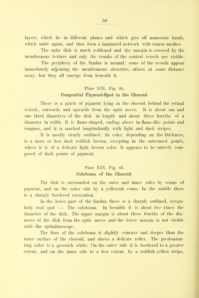 layers, which lie in different planes and which give off numerous hands, which unite again, and thus form a laminated network with coarse meshes. The optic disk is much reddened and the margin is covered hy the membranous texture and only the trunks of the central vessels are, visible. The periphery of the fundus is normal; some of the vessels appear immediately adjoining the membranous structure, others at some distance away, but they all emerge from beneath it. Plate XIX. Fig. 85. Congenital Pigment-Spot in the Choroid. There is a patch of pigment lying in the choroid behind the retinal vessels, outwards and upwards from the optic nerve. It is about one and one third diameters of the disk in length and about three fourths of a diameter in width. It is flame-shaped, ending above in flame-like points and tongues, and it is marked longitudinally with light and dark stripes. Tt is mostly clearly outlined; its color, depending on the thickness, is a more or less dark reddish brown, excepting in the outermost points, where it is of a delicate light brown color. It appears to be entirely com- posed of dark points of pigment. Plate XIX. Fig. 86. Coloboma of the Choroid. The disk is surrounded on the outer and inner sides by seams of pigment, and on the outer side by a yellowish conus. In the middle there is a sharply bordered excavation. In the lower part of the fundus, there is a sharply outlined, irregu- larly oval spot — The coloboma. In breadth it is about five times the diameter of the disk. The upper margin is about three fourths of the dia- meter of the disk from the optic nerve and the lower margin is not visible with the opthalmoscope. The floor of the coloboma is slightly concave and deeper than the inner surface of the choroid, and shows a delicate reflex. Tbe predomina- ting color is a greenish white. On the outer side it is bordered to a greater extent, and on the inner side to a less extent, by a reddish yellow stripe,
