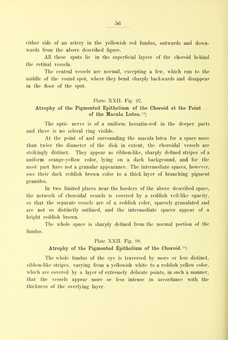 either side of an artery in the yellowish red fundus, outwards and down- wards from the ahove described figure. All these spots lie in the superficial layers of the choroid behind the retinal vessels. The central vessels are normal, excepting a few, which run to the middle of the round spot, where they bend sharply backwards and disappear in the floor of the spot. Platte XXII. Fig. 97. Atrophy of the Pigmented Epithelium of the Choroid at the Point of the Macula Lutea.29) The optic nerve is of a uniform hematin-red in the deeper parts and there is no scleral ring visible. At the point of and surrounding the macula lutea for a space more than twice the diameter of the disk in extent, the choroidal vessels are strikingly distinct. They appear as ribbon-like, sharply defined stripes of a uniform orange-yellow color, lying on a dark background, and for the most part have not a granular appearance. The intermediate spaces, however, owe their dark reddish brown color to a thick layer of branching pigment granules. In two limited places near the borders of the above described space, the network of choroidal vessels is covered by a reddish veil-like opacity, so that the separate vessels are of a reddish color, sparsely granulated and are not so distinctly outlined, and the intermediate spaces appear of a bright reddish brown. The whole space is sharply defined from the normal portion of the fundus. Plate XXII. Fig. 98. Atrophy of the Pigmented Epithelium of the Choroid.3o) The whole fundus of the eye is traversed by more or less distinct, ribbon-like stripes, varying from a yellowish white to a reddish yellow color, which are covered by a layer of extremely delicate points, in such a manner, that the vessels appear more or less intense in accordance with the thickness of the overlying layer.