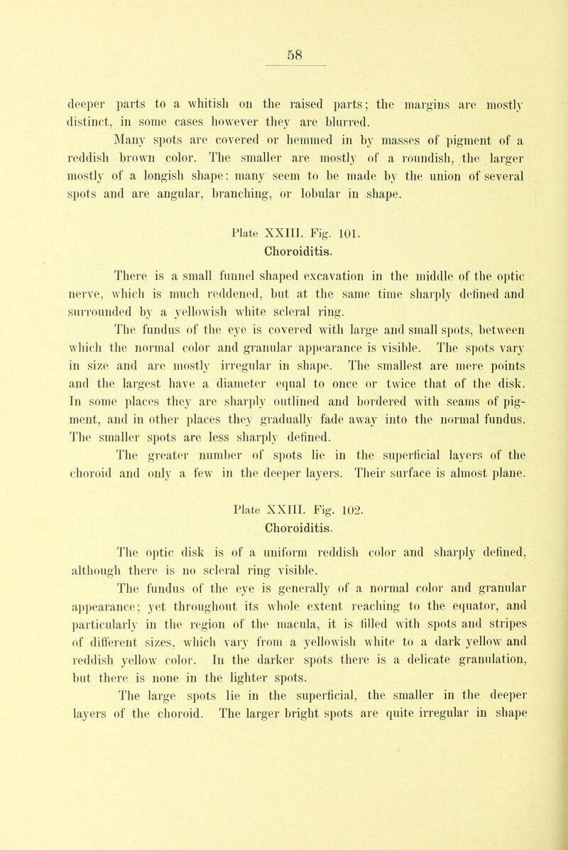 deeper parts to a whitish on the raised parts; the margins are mostly distinct, in some cases however they are blurred. Many spots are covered or hemmed in by masses of pigment of a reddish brown color. The smaller are mostly of a roundish, the larger mostly of a longish shape: many seem to be made by the union of several spots and are angular, branching, or lobular in shape. Plate XXIII. Fig. 101. Choroiditis. There is a small funnel shaped excavation in the middle of the optic nerve, which is much reddened, but at the same time sharply defined and surrounded by a yellowish white scleral ring. The fundus of the eye is covered with large and small spots, between which the normal color and granular appearance is visible. The spots vary in size and are mostly irregular in shape. The smallest are mere points and the largest have a diameter equal to once or twice that of the disk. In some places they are sharply outlined and bordered with seams of pig- ment, and in other places they gradually fade away into the normal fundus. The smaller spots are less sharply defined. The greater number of spots lie in the superficial layers of the choroid and only a few in the deeper layers. Their surface is almost plaue. Plate XXIII. Fig. 102. Choroiditis. The optic disk is of a uniform reddish color and sharply defined, although there is no scleral ring visible. The fundus of the eye is generally of a normal color and granular appearance; yet throughout its whole extent reaching to the equator, and particularly in the region of the macula, it is filled with spots and stripes of different sizes, which vary from a yellowish white to a dark yellow and reddish yellow color. In the darker spots there is a delicate granulation, but there is none in the lighter spots. The large spots lie in the superficial, the smaller in the deeper layers of the choroid. The larger bright spots are quite irregular in shape