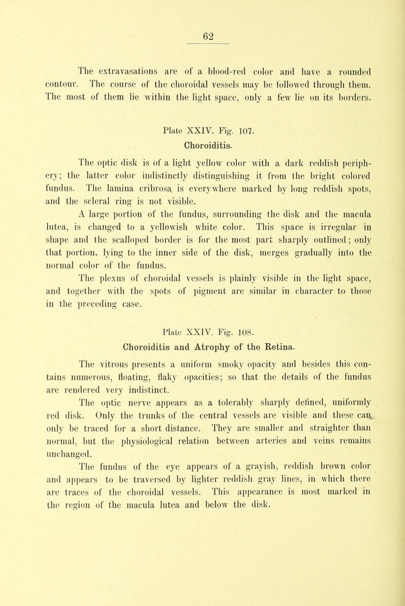 The extravasatioDS are of a blood-red color and have a rounded contour. The course of the choroidal vessels may be followed through them. The most of them lie within the light space, only a few lie on its borders. Plate XXIV. Fig. 107. Choroiditis. The optic disk is of a light yellow color with a dark reddish periph- ery; the latter color indistinctly distinguishing it from the bright colored fundus. The lamina cribrosa is everywhere marked by long reddish spots, and the scleral ring is not visible. A large portion of the fundus, surrounding the disk and the macula lutea, is changed to a yellowish white color. This space is irregular in shape and the scalloped border is for the most part sharply outlined; only that portion, lying to the inner side of the disk, merges gradually into the normal color of the fundus. The plexus of choroidal vessels is plainly visible in the light space, and together with the spots of pigment are similar in character to those in the preceding case. Plate XXIV. Fig. 108. Choroiditis and Atrophy of the Retina. The vitrous presents a uniform smoky opacity and besides this con- tains numerous, floating, flaky opacities; so that the details of the fundus are rendered very indistinct. The optic nerve appears as a tolerably sharply defined, uniformly red disk. Only the trunks of the central vessels are visible and these can,, only be traced for a short distance. They are smaller and straighter than normal, but the physiological relation between arteries and veins remains unchanged. The fundus of the eye appears of a grayish, reddish brown color and appears to be traversed by lighter reddish gray lines, in which there are traces of the choroidal vessels. This appearance is most marked in the region of the macula lutea and below the disk.