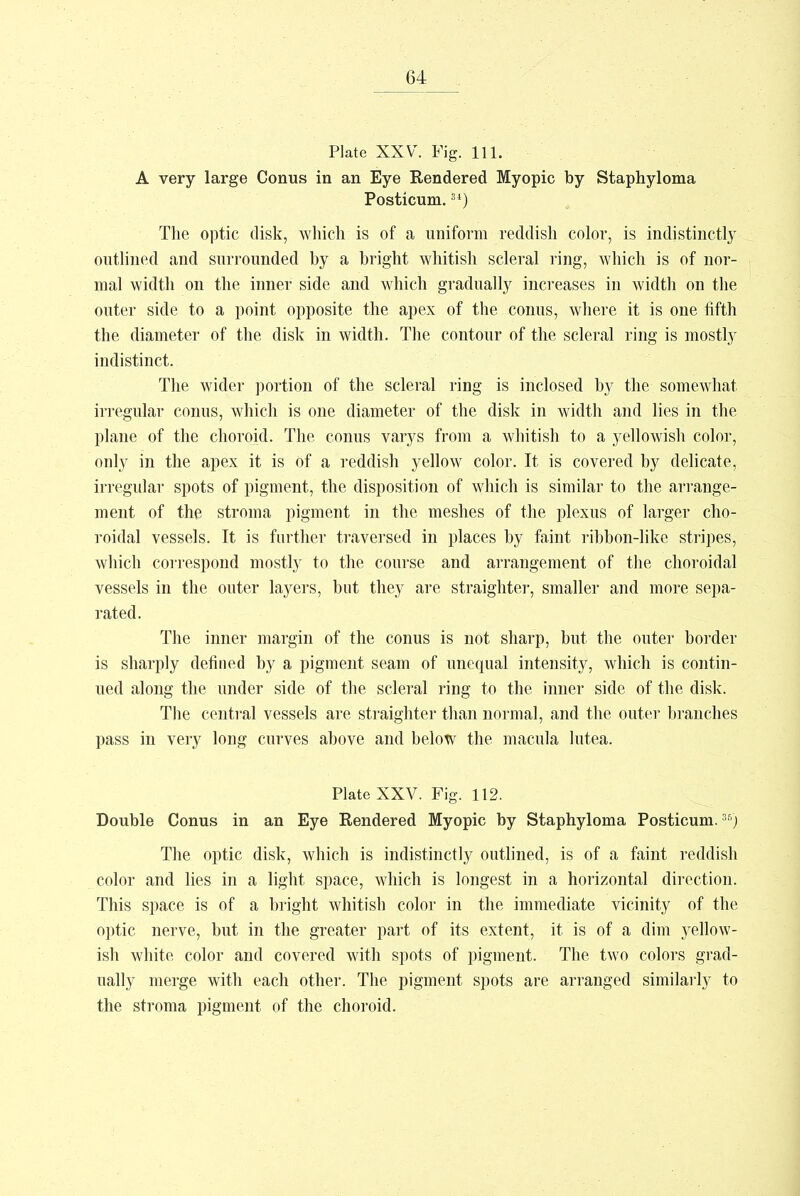 Plate XXV. Fig. 111. A very large Conus in an Eye Rendered Myopic by Staphyloma Posticum.Si) The optic disk, which is of a uniform reddish color, is indistinctly outlined and surrounded by a bright whitish scleral ring, which is of nor- mal width on the inner side and which gradually increases in width on the outer side to a point opposite the apex of the conus, where it is one fifth the diameter of the disk in width. The contour of the scleral ring is mostly indistinct. The wider portion of the scleral ring is inclosed by the somewhat irregular conus, which is one diameter of the disk in width and lies in the plane of the choroid. The conus varys from a whitish to a yellowish color, only in the apex it is of a reddish yellow color. It is covered by delicate, irregular spots of pigment, the disposition of which is similar to the arrange- ment of the stroma pigment in the meshes of the plexus of larger cho- roidal vessels. It is further traversed in places by faint ribbon-like stripes, which correspond mostly to the course and arrangement of the choroidal vessels in the outer layers, but they are straighter, smaller and more sepa- rated. The inner margin of the conus is not sharp, but the outer border is sharply defined by a pigment seam of unequal intensity, which is contin- ued along the under side of the scleral ring to the inner side of the disk. The central vessels are straighter than normal, and the outer branches pass in very long curves above and below the macula lutea. Plate XXV. Fig. 112. Double Conus in an Eye Rendered Myopic by Staphyloma Posticum. 3B) The optic disk, which is indistinctly outlined, is of a faint reddish color and lies in a light space, which is longest in a horizontal direction. This space is of a bright whitish color in the immediate vicinity of the optic nerve, but in the greater part of its extent, it is of a dim 3rellow- ish white color and covered with spots of pigment. The two colors grad- ually merge with each other. The pigment spots are arranged similarly to the stroma pigment of the choroid.
