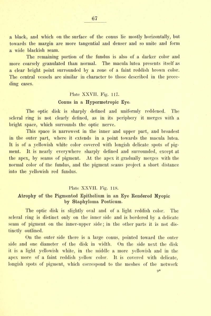 a black, and which on the surface of the conus lie mostly horizontally, but towards the margin are more tangential and denser and so unite and form a wide blackish seam. The remaining portion of the fundus is also of a darker color aud more coarsely granulated than normal. The macula lutea presents itself as a clear bright point surrounded by a zone of a faint reddish brown color. The central vessels are similar in character to those described in the prece- ding cases. Plate XXVII. Fig. 117. Conus in a Hypermetropic Eye. The optic disk is sharply defined and uniformly reddened. The scleral ring is not clearly defined, as in its periphery it merges with a bright space, which surrounds the optic nerve. This space is narrowest in the inner and upper part, and broadest in the outer part, where it extends in a point towards the macula lutea. It is of a yellowish white color covered with longish delicate spots of pig- ment. It is nearly everywhere sharply defined and surrounded, except at the apex, by seams of pigment. At the apex it gradually merges with the normal color of the fundus, and the pigment seams project a short distance into the yellowish red fundus. Plate XXVII. Fig. 118. Atrophy of the Pigmented Epithelium in an Eye Rendered Myopic by Staphyloma Posticum. The optic disk is slightly oval and of a light reddish color. The scleral ring is distinct only on the inner side and is bordered by a delicate seam of pigment on the inner-upper side; in the other parts it is not dis- tinctly outlined. On the outer side there is a large conus, pointed toward the outer side and one diameter of the disk in width. On the side next the disk it is a light yellowish white, in the middle a more yellowish and in the apex more of a faint reddish yellow color. It is covered with delicate, longish spots of pigment, which correspond to the meshes of the network 9*