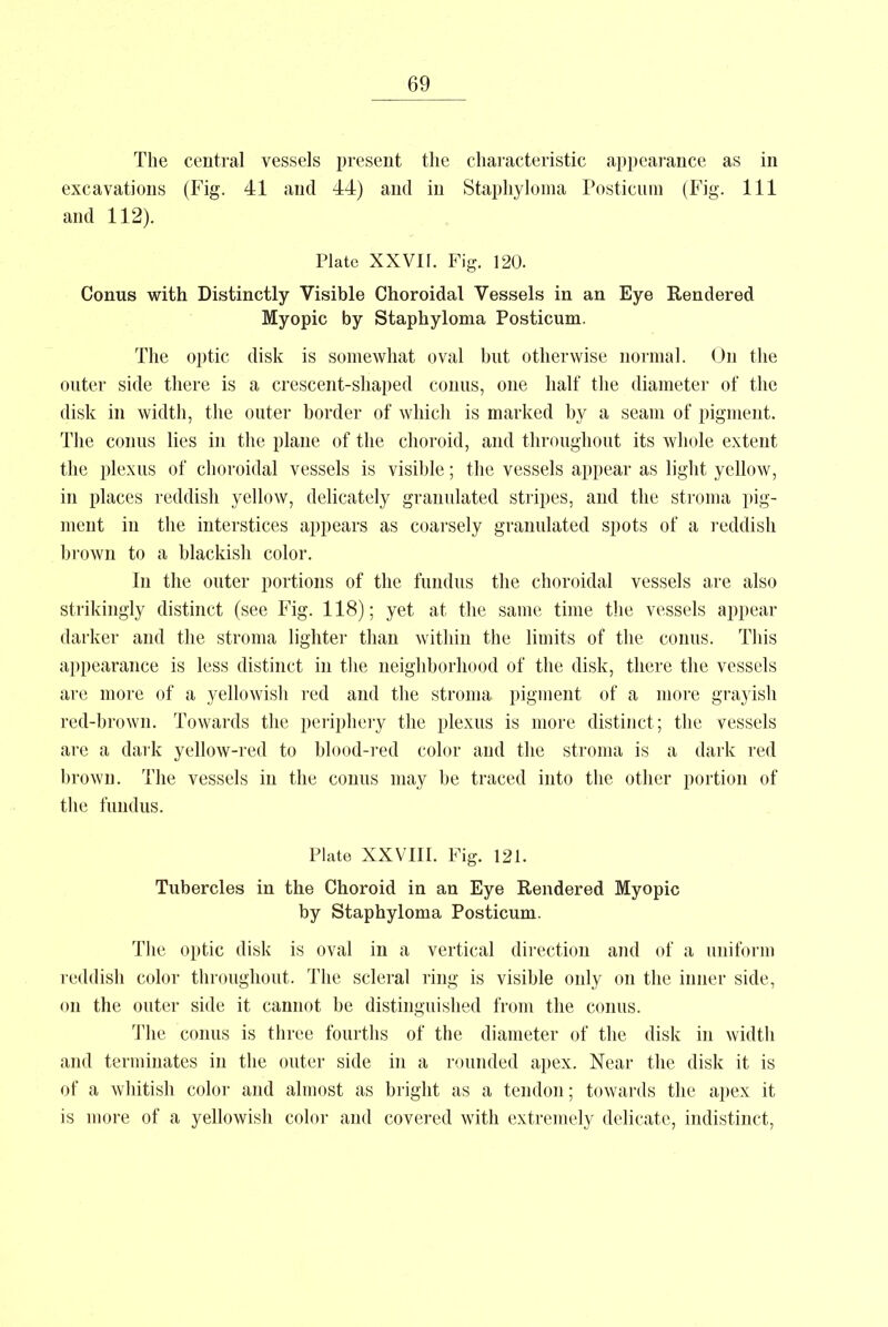 The central vessels present the characteristic appearance as in excavations (Fig. 41 and 44) and in Staphyloma Posticura (Fig. Ill and 112). Plate XXVIr. Fig. 120. Conus with Distinctly Visible Choroidal Vessels in an Eye Rendered Myopic by Staphyloma Posticum. The optic disk is somewhat oval but otherwise normal. On the outer side there is a crescent-shaped conus, one half the diameter of the disk in width, the outer border of which is marked by a seam of pigment. The conus lies in the plane of the choroid, and throughout its whole extent the plexus of choroidal vessels is visible; the vessels appear as light yellow, in places reddish yellow, delicately granulated stripes, and the stroma pig- ment in the interstices appears as coarsely granulated spots of a reddish brown to a blackish color. In the outer portions of the fundus the choroidal vessels are also strikingly distinct (see Fig. 118); yet at the same time the vessels appear darker and the stroma lighter than within the limits of the conus. This appearance is less distinct in the neighborhood of the disk, there the vessels are more of a yellowish red and the stroma pigment of a more grayish red-brown. Towards the periphery the plexus is more distinct; the vessels are a dark yellow-red to blood-red color and the stroma is a dark red brown. The vessels in the conus may be traced into the other portion of the fundus. Plate XXVIII. Fig. 121. Tubercles in the Choroid in an Eye Rendered Myopic by Staphyloma Posticum. The optic disk is oval in a vertical direction and of a uniform reddish color throughout. The scleral ring is visible only on the inner side, on the outer side it cannot be distinguished from the conus. The conus is three fourths of the diameter of the disk in width and terminates in the outer side in a rounded apex. Near the disk it is of a whitish color and almost as bright as a tendon; towards the apex it is more of a yellowish color and covered with extremely delicate, indistinct,