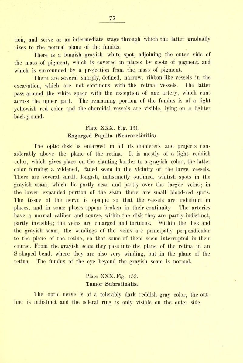 tioii, aud serve as an intermediate stage through which the latter gradually rizes to the normal plane of the fundus. There is a longish grayish white spot, adjoining the outer side of the mass of pigment, which is covered in places by spots of pigment, and which is surrounded by a projection from the mass of pigment. There are several sharply, defined, narrow, ribbon-like vessels in the excavation, which are not continous with the retinal vessels. The latter pass around the white space with the exception of one artery, which runs across the upper part. The remaining portion of the fundus is of a light yellowish red color and the choroidal vessels are visible, lying on a lighter background. Plate XXX. Fig. 131. Engorged Papilla (Neuroretinitis). The optic disk is enlarged in all its diameters and projects con- siderably above the plane of the retina. It is mostly of a light reddish color, which gives place on the slanting border to a grayish color; the latter color forming a widened, faded seam in the vicinity of the large vessels. There are several small, longish, indistinctly outlined, whitish spots in the grayish seam, which lie partly near and partly over the larger veins; in the lower expanded portion of the seam there are small blood-red spots. The tissue of the nerve is opaque so that the vessels are indistinct in places, and in some places appear broken in their continuity. The arteries have a normal caliber and course, within the disk they are partly indistinct, partly invisible; the veins are enlarged and tortuous. Within the disk and the grayish seam, the windings of the veins are principally perpendicular to the plane of the retina, so that some of them seem interrupted in their course. From the grayish seam they pass into the plane of the retina in an S-shaped bend, where they are also very winding, but in the plane of the retina. The fundus of the eye beyond the grayish seam is normal. Plate XXX. Fig. 132. Tumor Subretinalis. The optic nerve is of a tolerably dark reddish gray color, the out- line is indistinct and the scleral ring is only visible on the outer side.