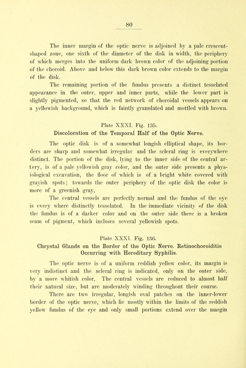 The inner margin of the optic nerve is adjoined by a pale crescent- shaped zone, one sixth of the diameter of the disk in width, the periphery of which merges into the uniform dark brown color of the adjoining portion of the choroid. Above and below this dark brown color extends to the margin of the disk. The remaining portion of the fundus presents a distinct tesselated appearance in the outer, upper and inner parts, while the lower part is slightly pigmented, so that the red network of choroidal vessels appears on a yellowish background, which is faintly granulated and mottled with brown. Plate XXXI. Fig. 135. Discoloration of the Temporal Half of the Optic Nerve. The optic disk is of a somewhat longish elliptical shape, its bor- ders are sharp and somewhat irregular and the scleral ring is everywhere distinct. The portion of the disk, lying to the inner side of the central ar- tery, is of a pale yellowish gray color, and the outer side presents a phys- iological excavation, the floor of which is of a bright white covered with grayish spots; towards the outer periphery of the optic disk the color is more of a greenish gray. The central vessels are perfectly normal and the fundus of the eye is every where distinctly tesselated. In the immediate vicinity of the disk the fundus is of a darker color and on the outer side there is a broken seam of pigment, which incloses several yellowish spots. Plate XXXI. Fig. 136. Chrystal Glands on the Border of the Optic Nerve. Retinochoroiditis Occurring with Hereditary Syphilis. The optic nerve is of a uniform reddish yellow color, its margin is very indistinct and the scleral ring is indicated, only on the outer side, by a more whitish color. The central vessels are reduced to almost half their natural size, but are moderately winding throughout their course. There are two irregular, longish oval patches on the inner-lower border of the optic nerve, which lie mostly within the limits of the reddish yellow fundus of the eye and only small portions extend over the margin