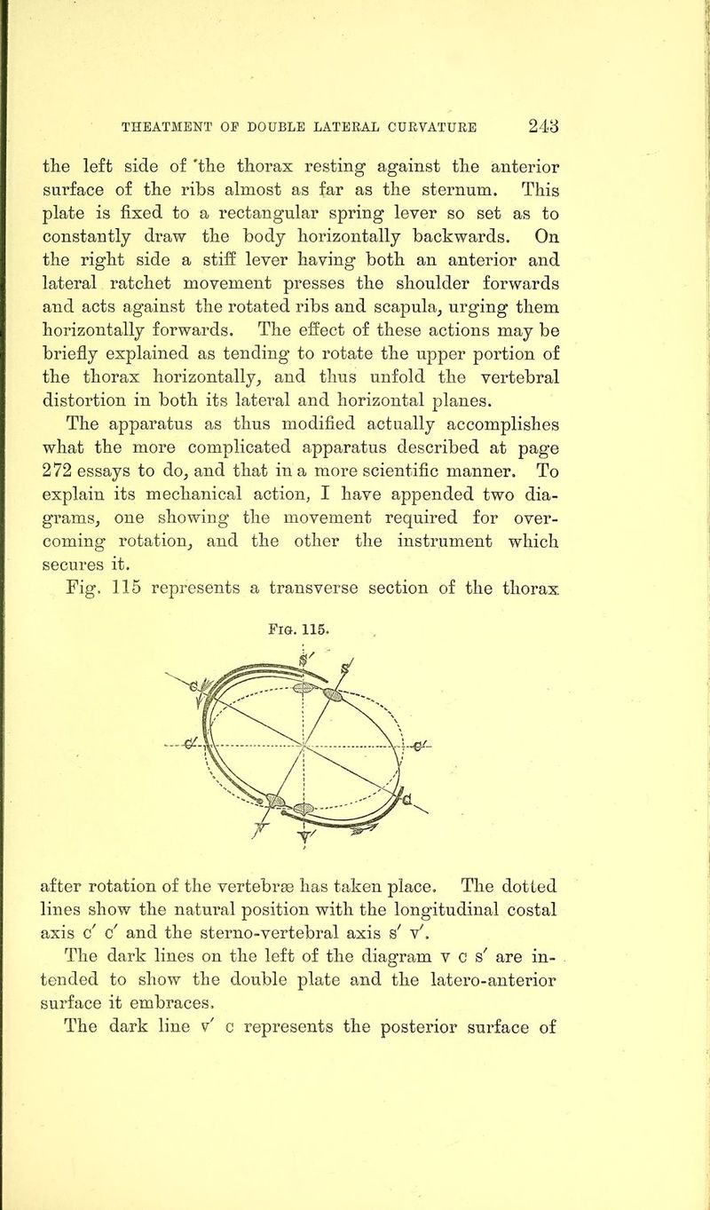 the left side of 'the thorax resting against the anterior surface of the ribs almost as far as the sternum. This plate is fixed to a rectangular spring lever so set as to constantly draw the body horizontally backwards. On the right side a stiff lever having both an anterior and lateral ratchet movement presses the shoulder forwards and acts against the rotated ribs and scapula, urging them horizontally forwards. The effect of these actions may be briefly explained as tending to rotate the upper portion of the thorax horizontally, and thus unfold the vertebral distortion in both its lateral and horizontal planes. The apparatus as thus modified actually accomplishes what the more complicated apparatus described at page 272 essays to do, and that in a more scientific manner. To explain its mechanical action, I have appended two dia- grams, one showing the movement required for over- coming rotation, and the other the instrument which secures it. Fig, 115 represents a transverse section of the thorax Fig. 115, after rotation of the vertebrae has taken place. The dotted lines show the natural position with the longitudinal costal axis c' c' and the sterno-vertebral axis s' v'. The dark lines on the left of the diagram vcs; are in- tended to show the double plate and the latero-anterior surface it embraces. The dark line v' c represents the posterior surface of