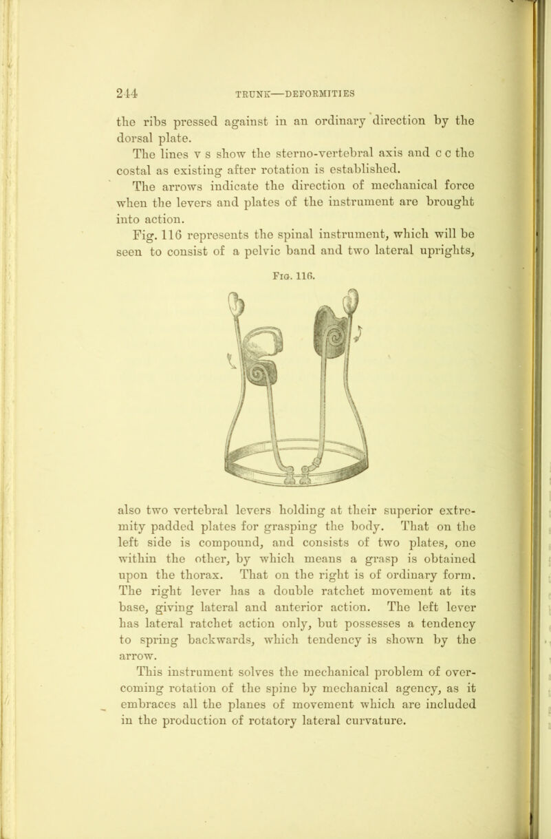tlie ribs pressed against in an ordinary direction by the dorsal plate. The lines v s show the sterno-vertebral axis and c c the costal as existing after rotation is established. The arrows indicate the direction of mechanical force when the levers and plates of the instrument are brought into action. Fig. 116 represents the spinal instrument, which will be seen to consist of a pelvic band and two lateral uprights. Fig. 116. also two vertebral levers holding at their superior extre- mity padded plates for grasping the body. That on the left side is compound, and consists of two plates, one within the other, by which means a grasp is obtained upon the thorax. That on the right is of ordinary form. The right lever has a double ratchet movement at its base, giving lateral and anterior action. The left lever has lateral ratchet action only, but possesses a tendency to spring backwards, which tendency is shown by the arrow. This instrument solves the mechanical problem of over- coming rotation of the spine by mechanical agency, as it embraces all the planes of movement which are included in the production of rotatory lateral curvature.