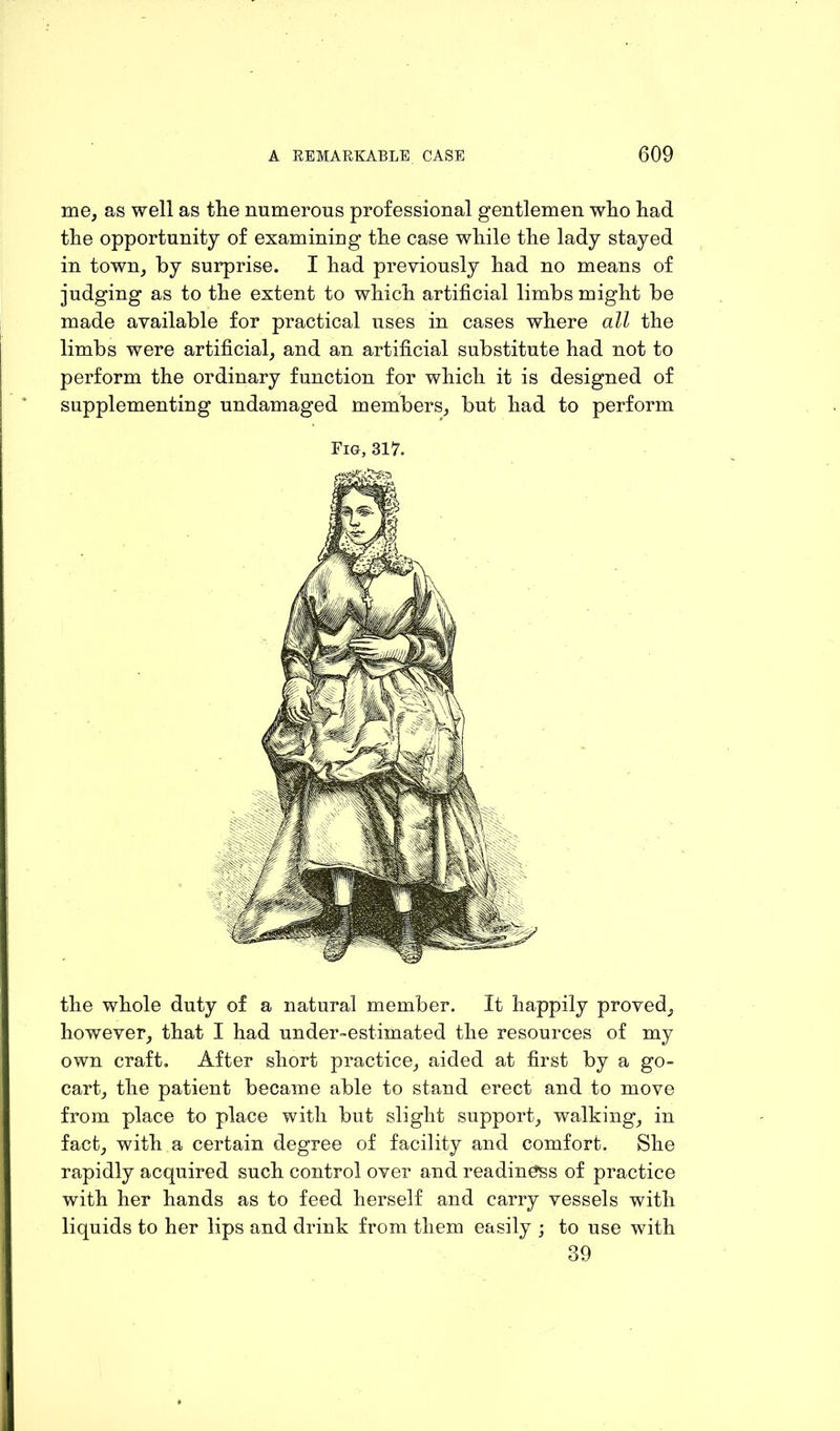 me, as well as tlie numerous professional gentlemen who had the opportunity of examining the case while the lady stayed in town, by surprise. I had previously had no means of judging as to the extent to which artificial limbs might be made available for practical uses in cases where all the limbs were artificial, and an artificial substitute had not to perform the ordinary function for which it is designed of supplementing undamaged members, but had to perform Fig, 317. the whole duty of a natural member. It happily proved, however, that I had under-estimated the resources of my own craft. After short practice, aided at first by a go- cart, the patient became able to stand erect and to move from place to place with but slight support, walking, in fact, with a certain degree of facility and comfort. She rapidly acquired such control over and readiness of practice with her hands as to feed herself and carry vessels with liquids to her lips and drink from them easily j to use with 39