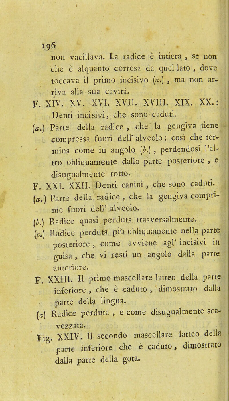not! vac'illava. La ladice e intiera , se iion die e alqiianto corrosa da quel lato , dove toccava il primo incisivo [a,) , ma non ar- riva alia sua cavita. F. Xiv. XV. XVI. XVII. XVIII. XIX. XX.: Denti incisivi, che sono caduti. [a.) Parte della radice , che la gengiva tiene compressa fuori deir alveolo: cosi che ter- inina come in angolo {h.) , perdendosi I'al- tro obliquamente dalla parte posteriore , e disugiialmente rotto. F. XXI. XXII. Demi canini, che sono caduti. {a.) Parte della radice, che la gengiva compri- me fuori dell'alveolo. [h.) Radice quasi perduta. trasversalmeirte. (c.) Radice perduta piii obliquamente nella parte posteriore , come avviene agl' incisivi in guisa, che vi resti un angolo dalla parte anteriore. F. XXni. II primo mascellare latteo della parte inferiore , che e caduto , dimostrato dalla parte della lingua. [a) Radice perduta , e come disugualmente sca- vezzata. Fig. XXIV. II secondo mascellare latteo della parte inferiore che e caduto, dimostrato dalla parte della gota.